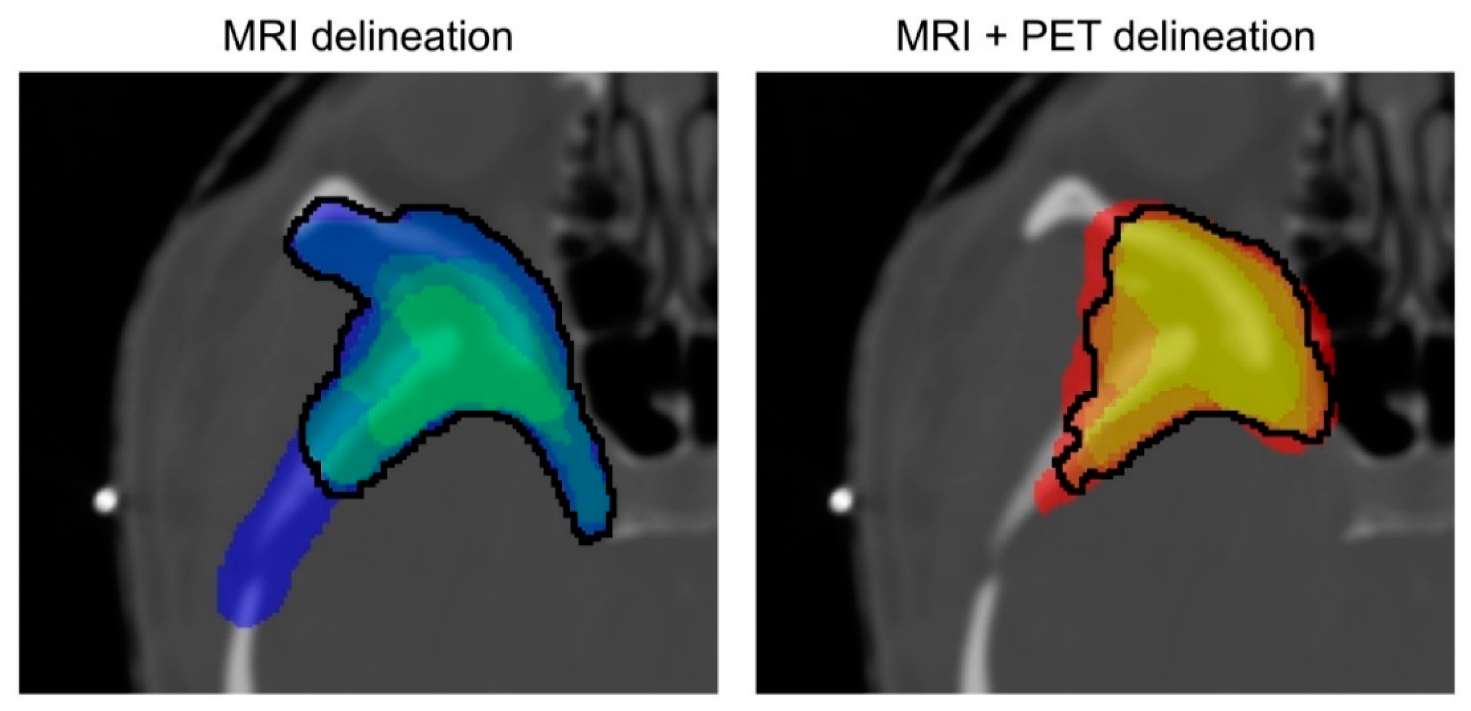 Cancers 14 04435 g001 Cancers 14 04435 g001