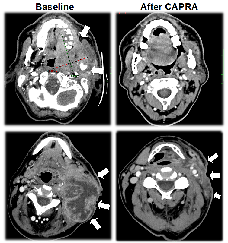 Cancers 14 04509 g003 Cancers 14 04509 g003