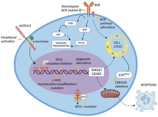 Cancers | Free Full-Text | Richter Syndrome: From Molecular ...