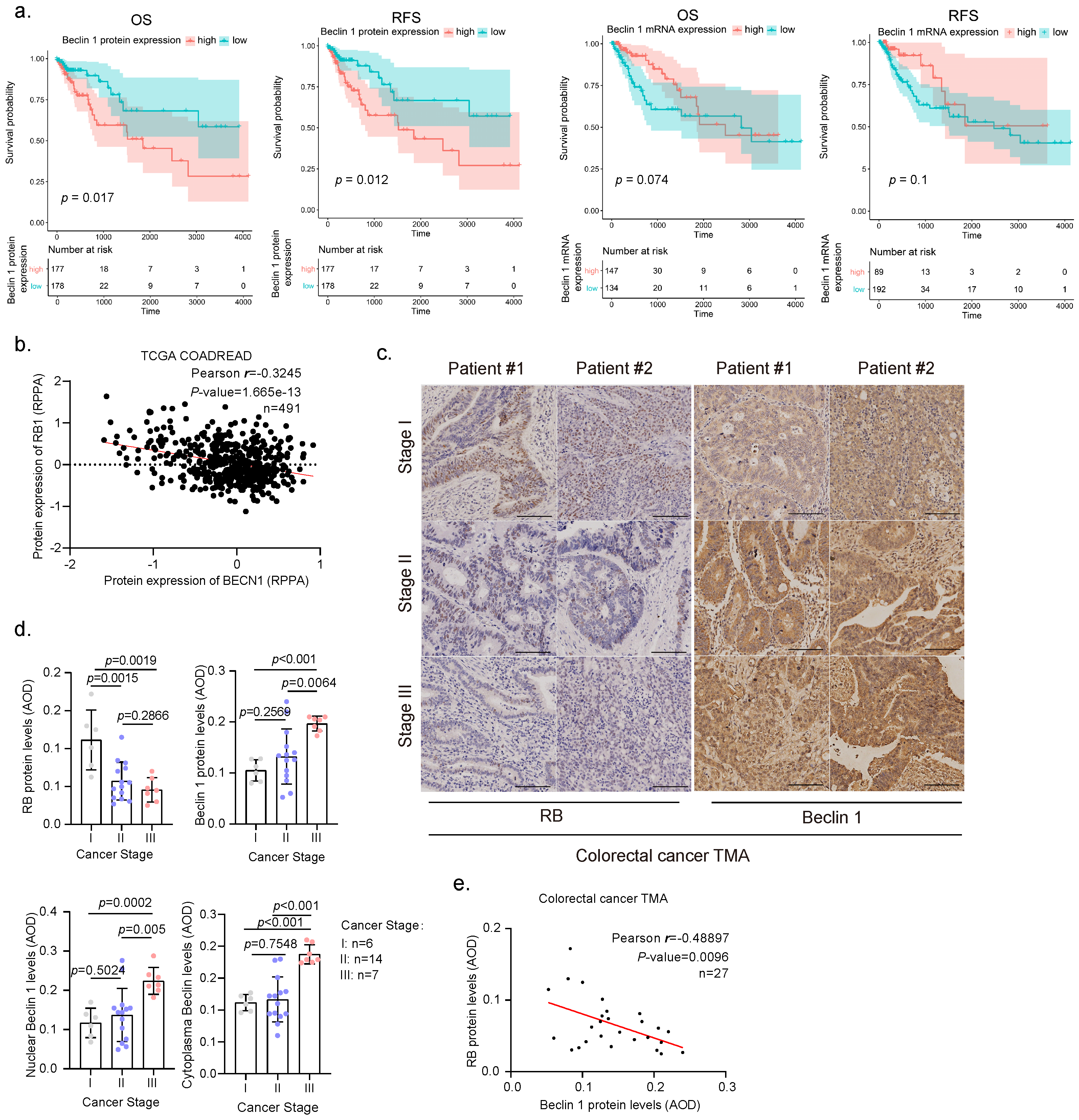 Cancers | Free Full-Text | Nuclear Beclin 1 Destabilizes 