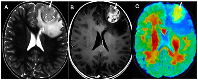 Cancers 14 04778 g008
