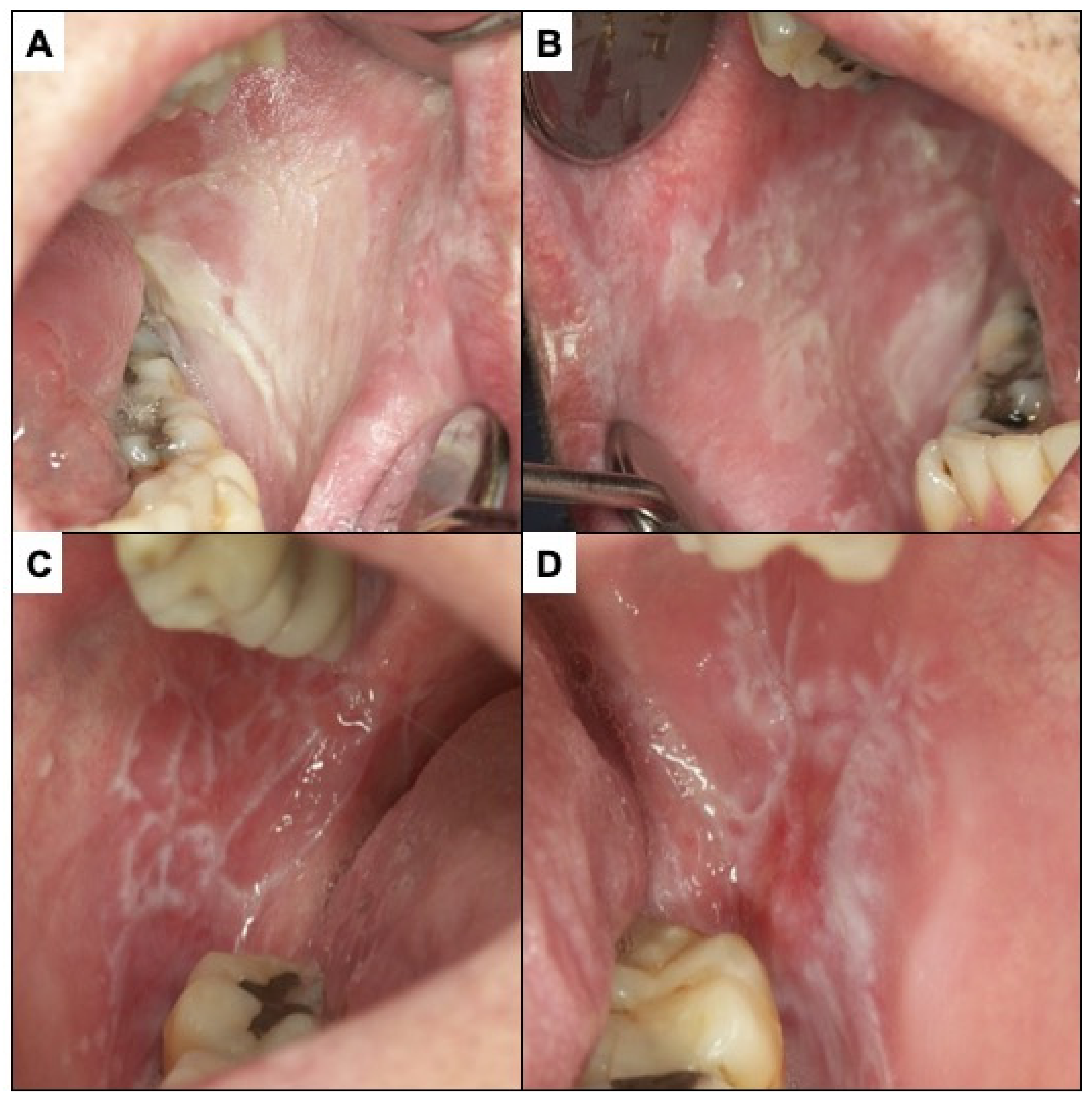 Cancers | Free Full-Text | Challenges in the Early Diagnosis of Oral  Cancer, Evidence Gaps and Strategies for Improvement: A Scoping Review of  Systematic Reviews