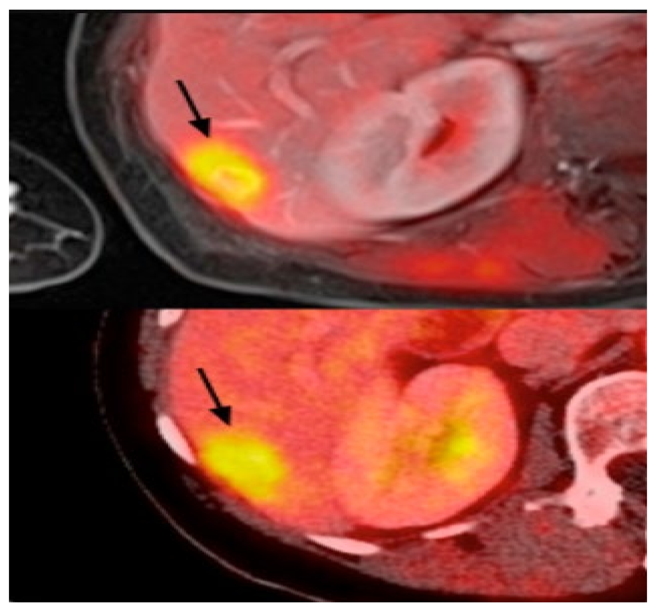 Cancers 14 05334 g006 Cancers 14 05334 g006