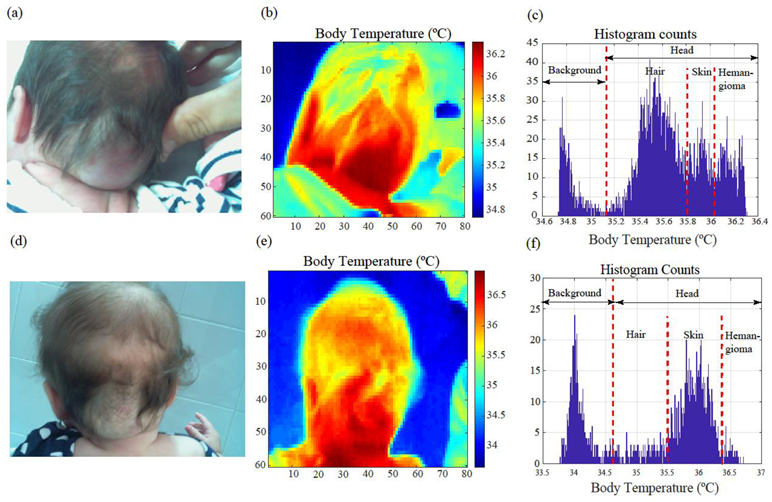 Cancers 14 05392 g004