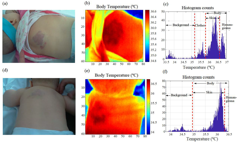 Cancers 14 05392 g005