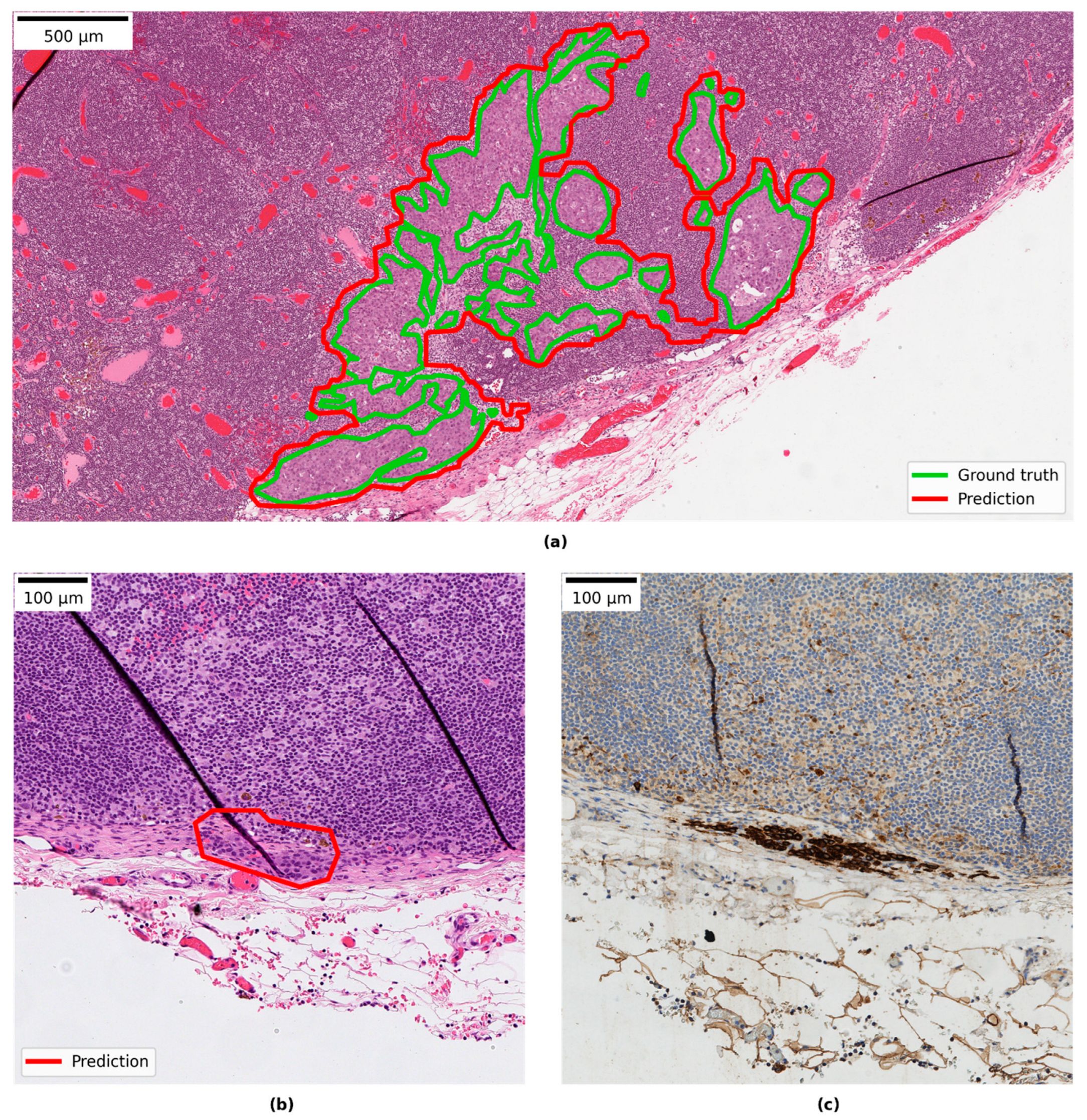 Cancers 14 05424 g004