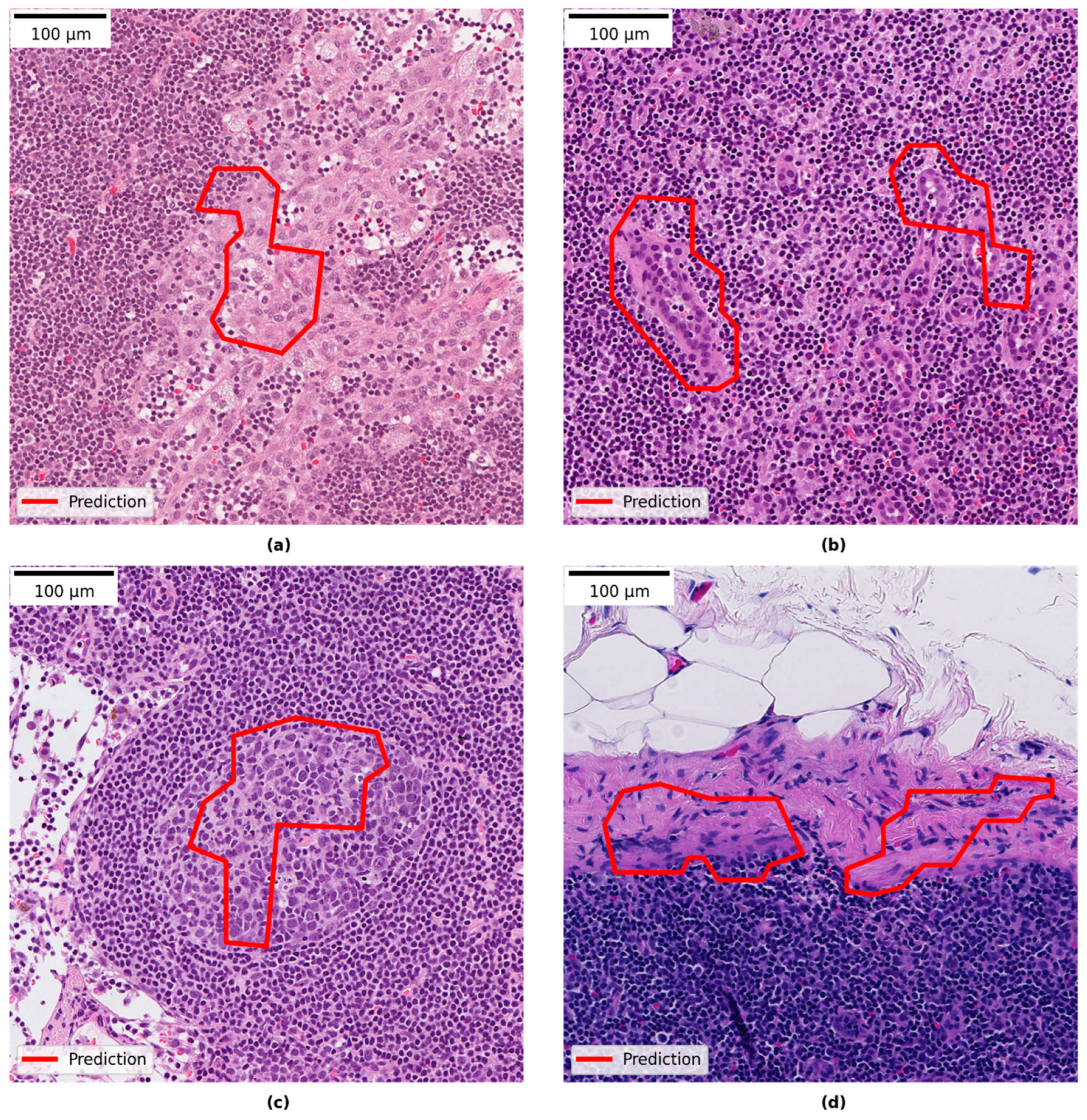 Cancers 14 05424 g005