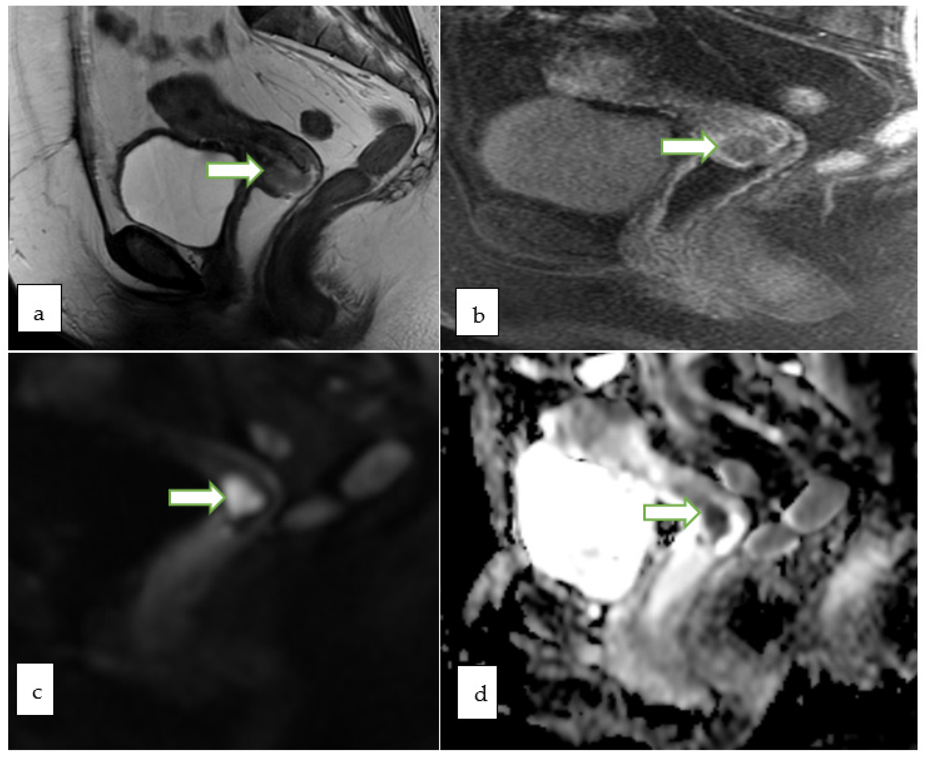 Cancers 14 05528 g007