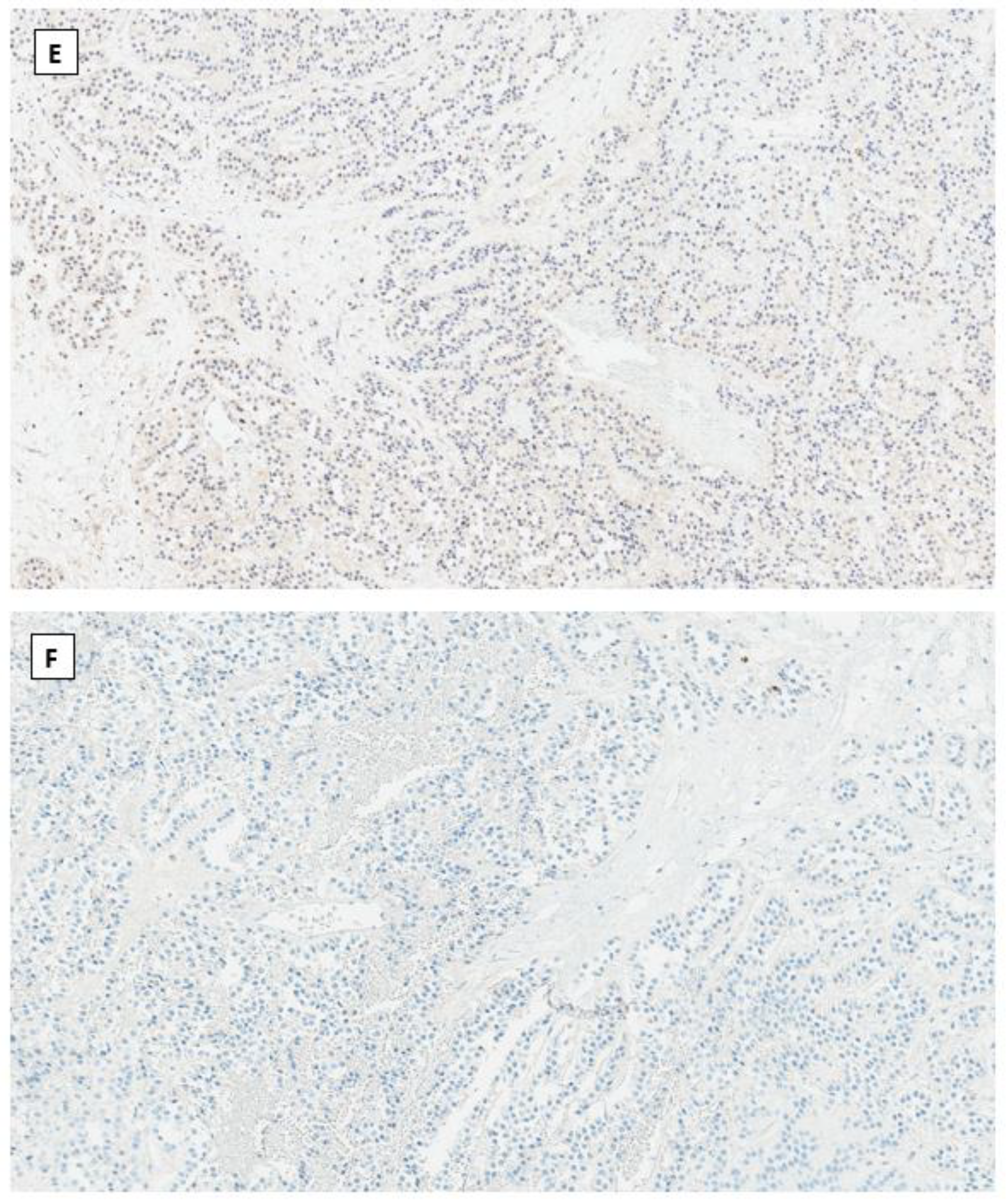 Cancers 14 05622 g001c