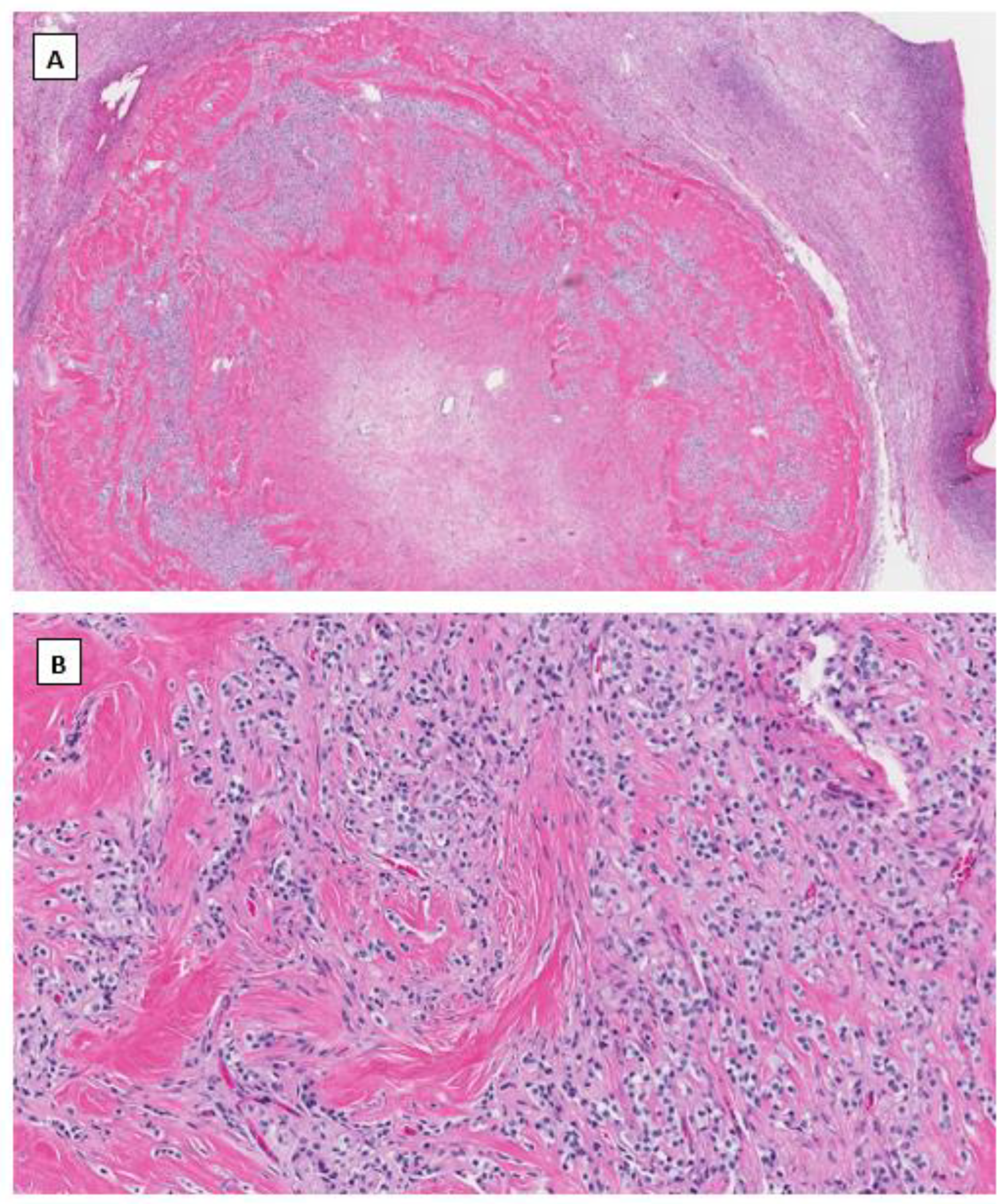 Cancers 14 05622 g002a