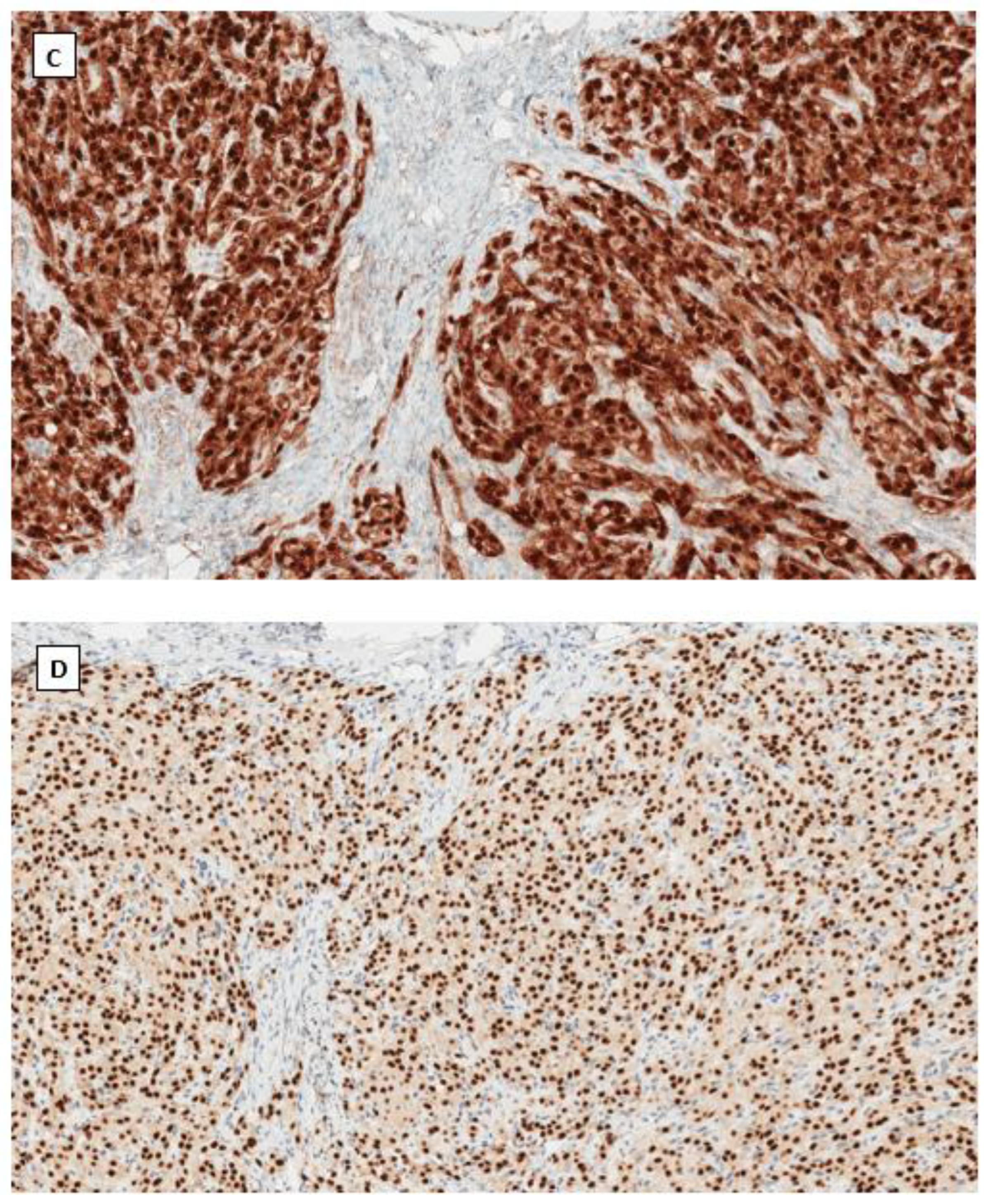 Cancers 14 05622 g002b