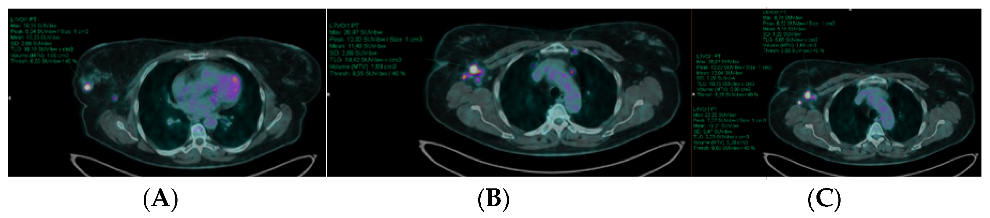 Cancers 14 05869 g001