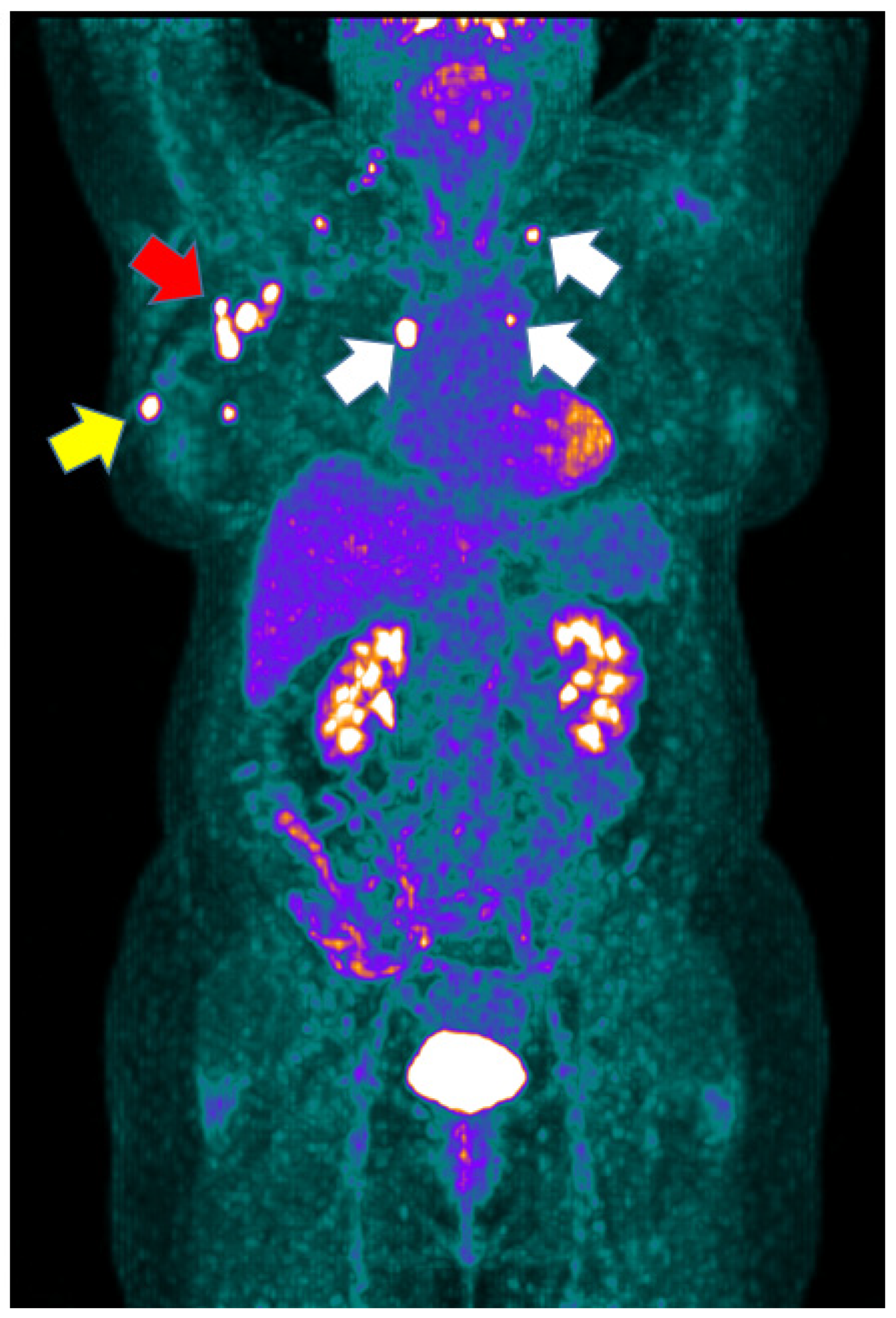 Cancers 14 05869 g004