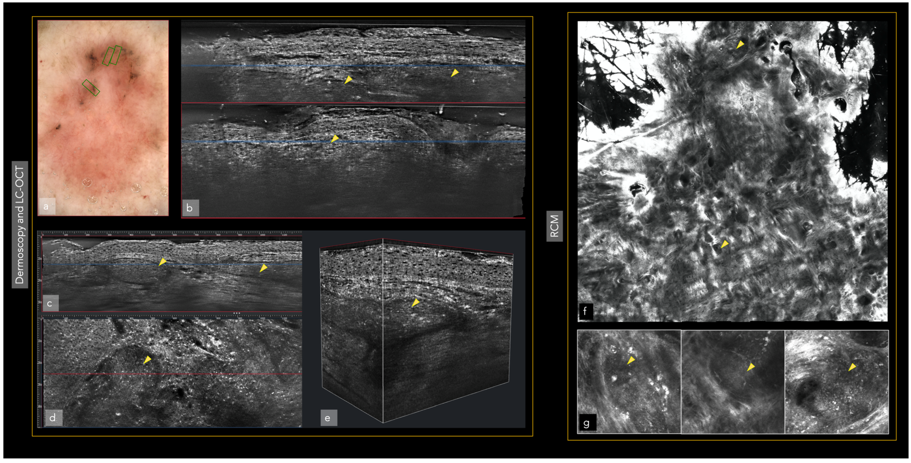 Cancers 14 05886 g002