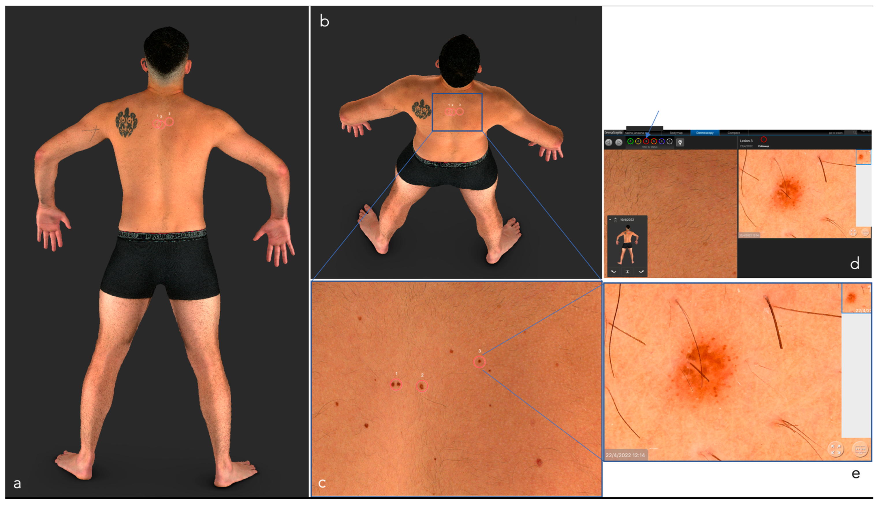 Cancers 14 05886 g003