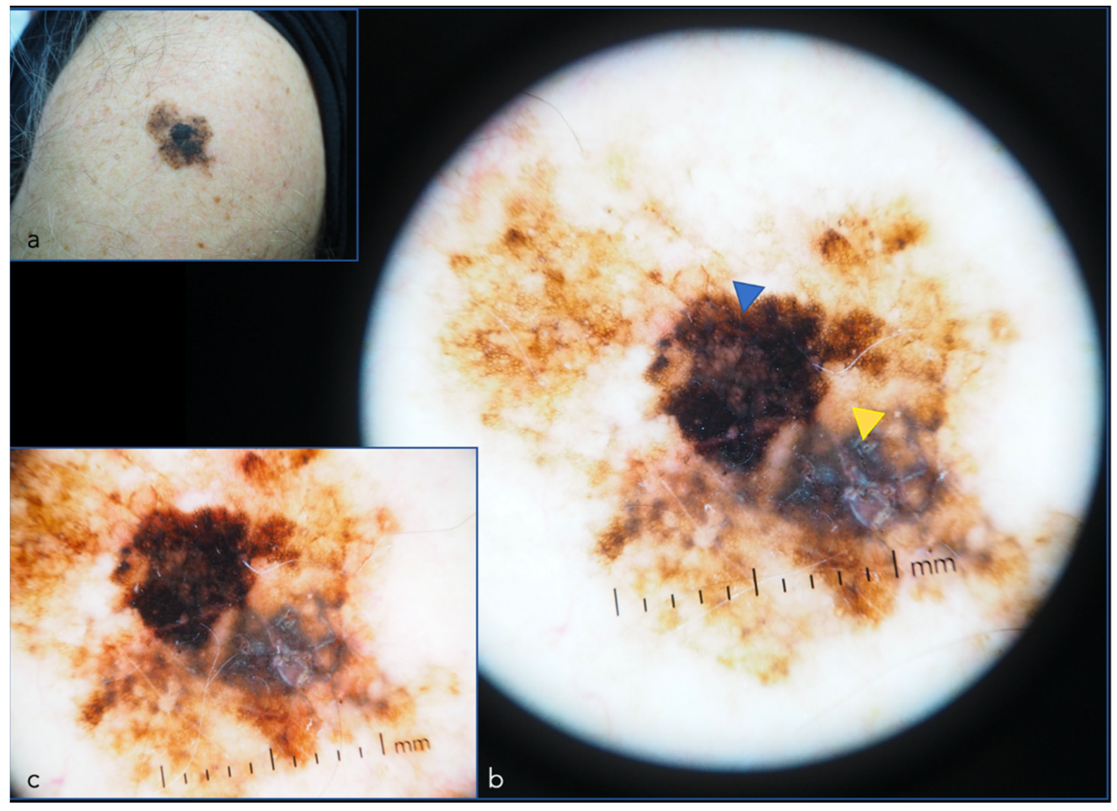 Cancers 14 05886 g006