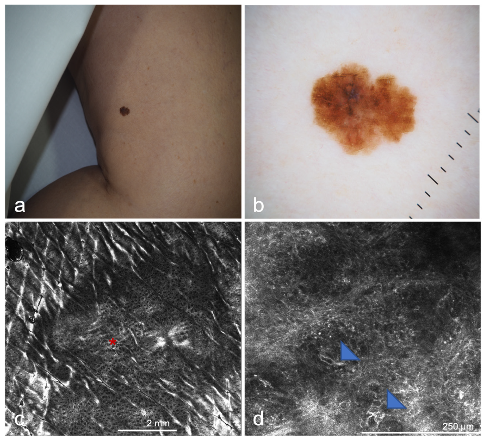 Cancers 14 05886 g007