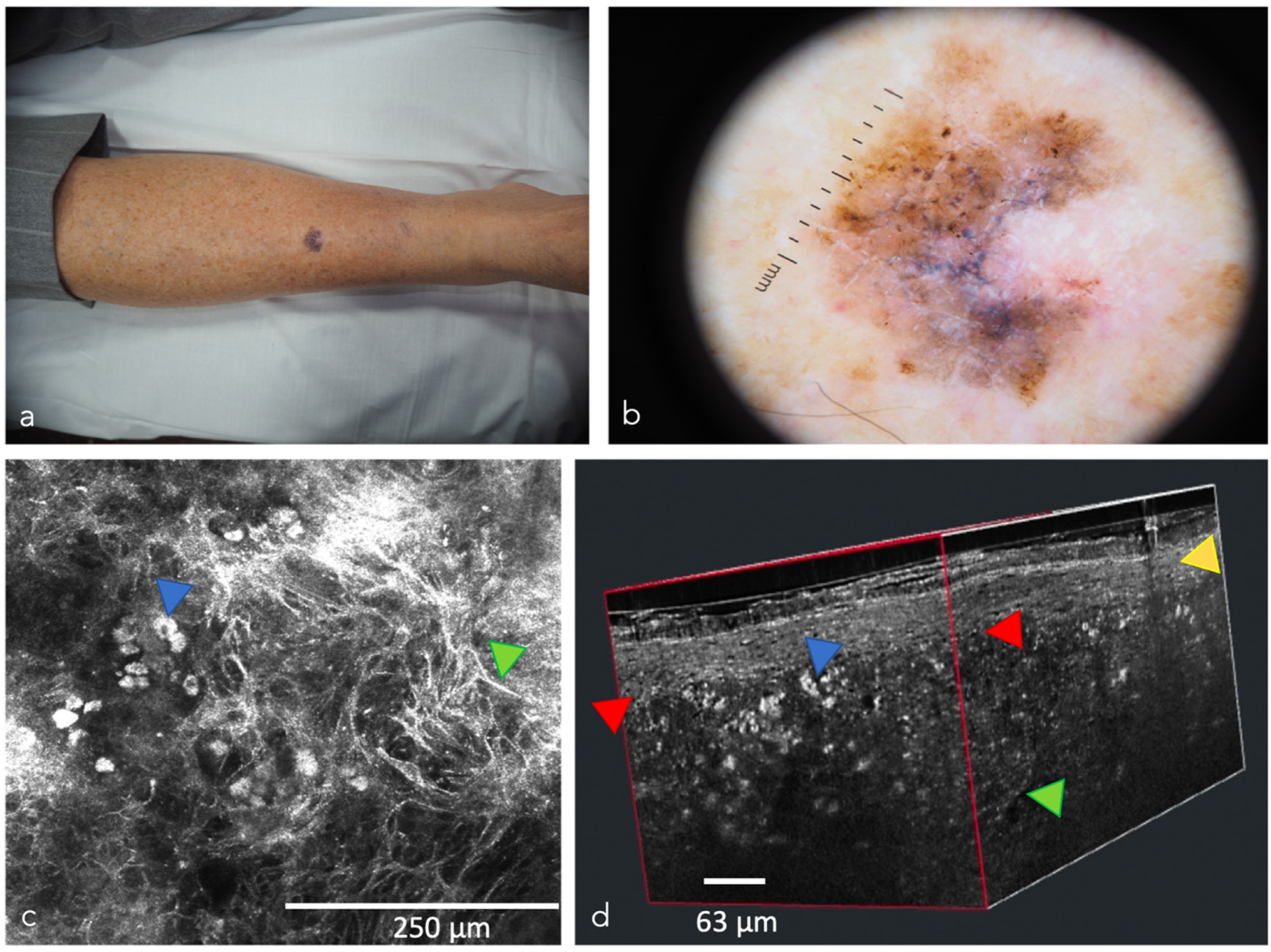 Cancers 14 05886 g008