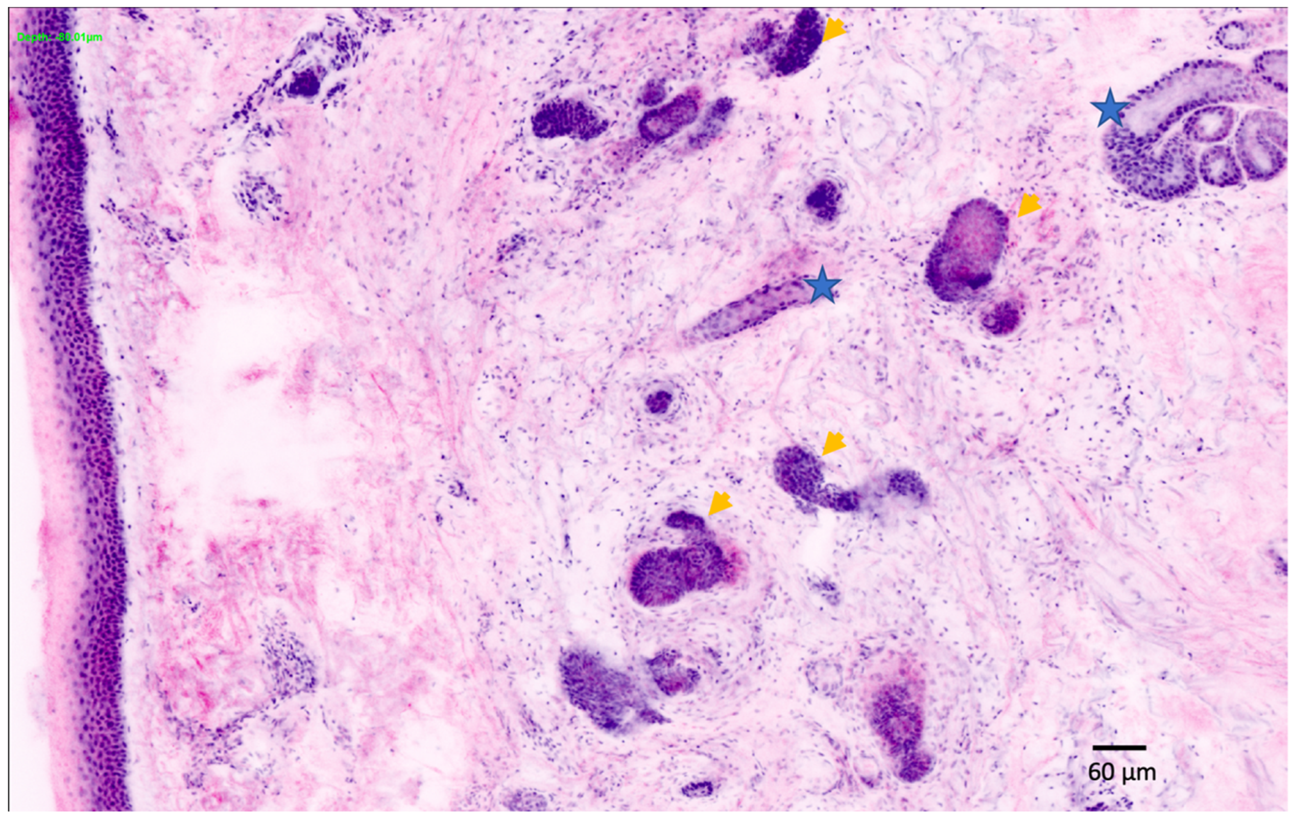 Cancers 14 05886 g010