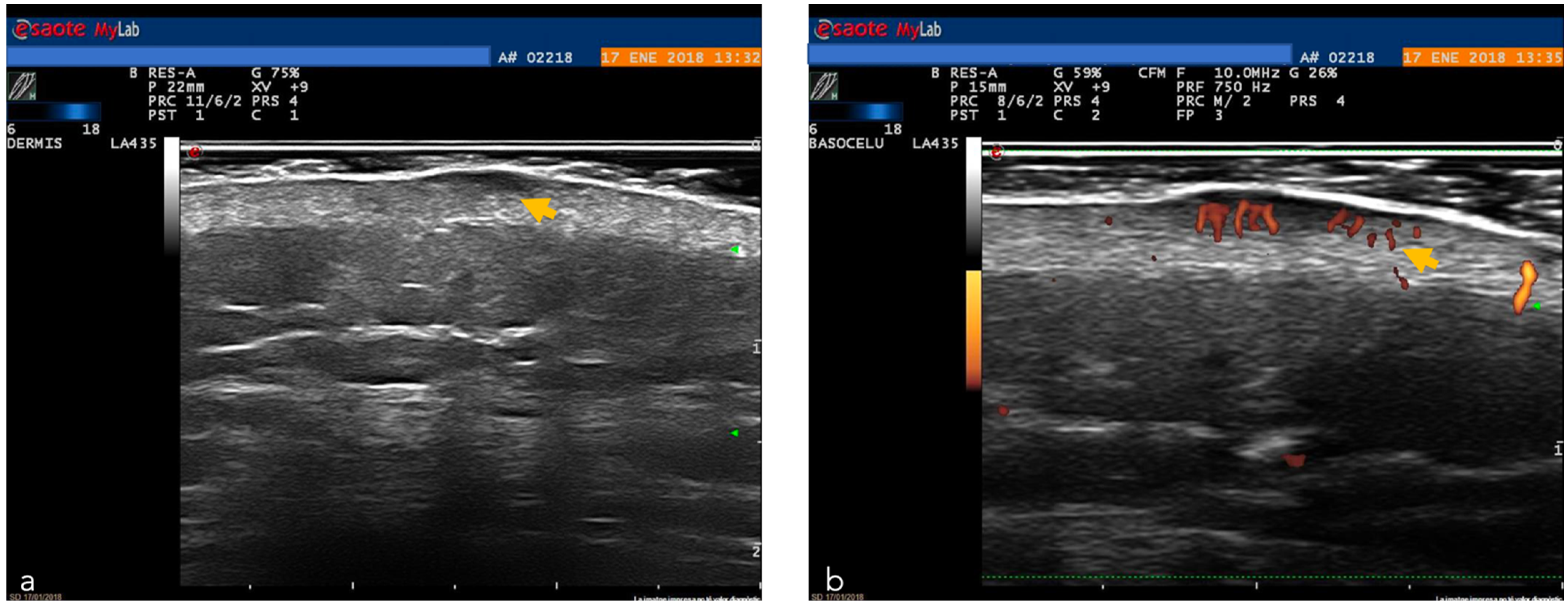 Cancers 14 05886 g012