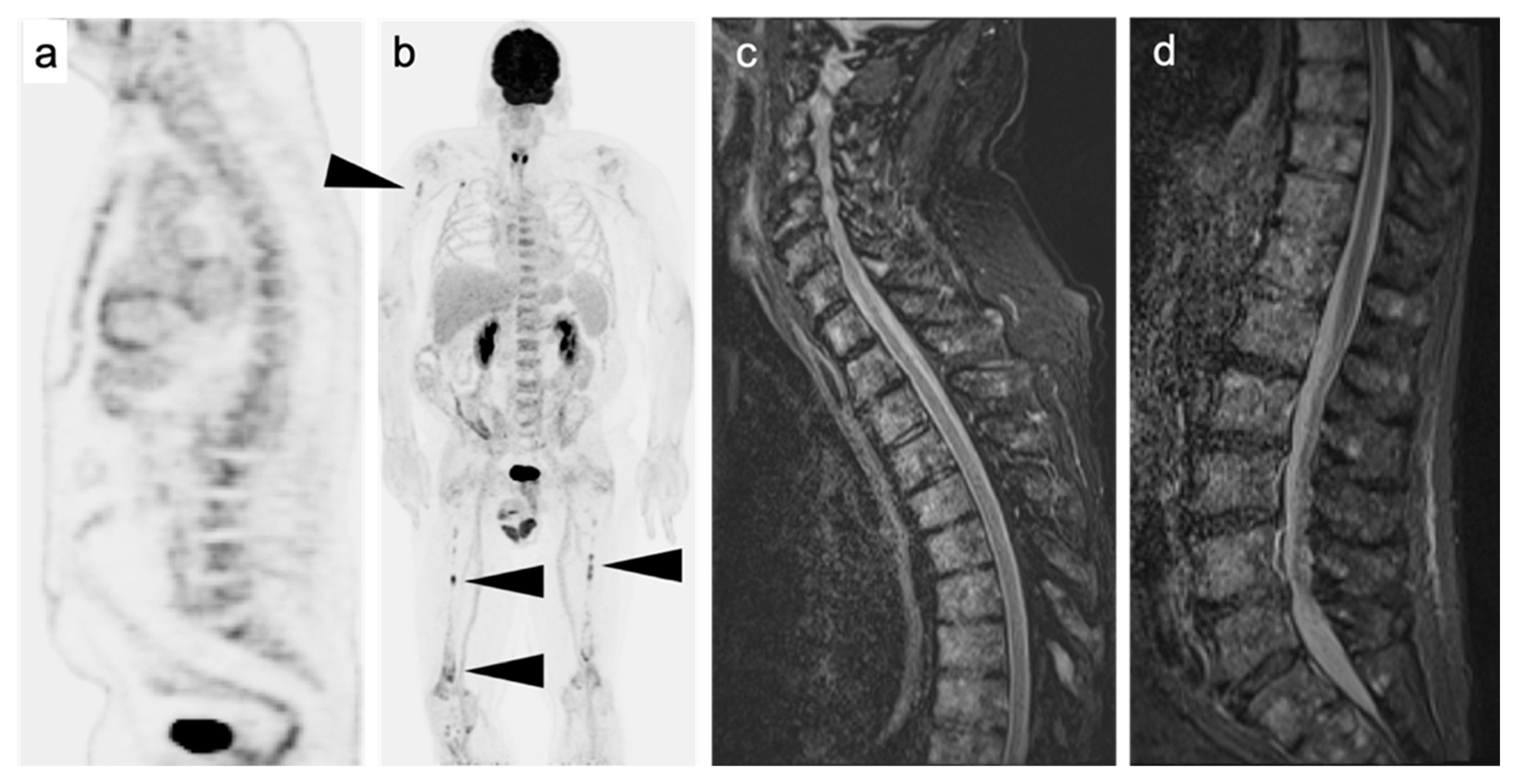 Cancers 14 05941 g007 Cancers 14 05941 g007