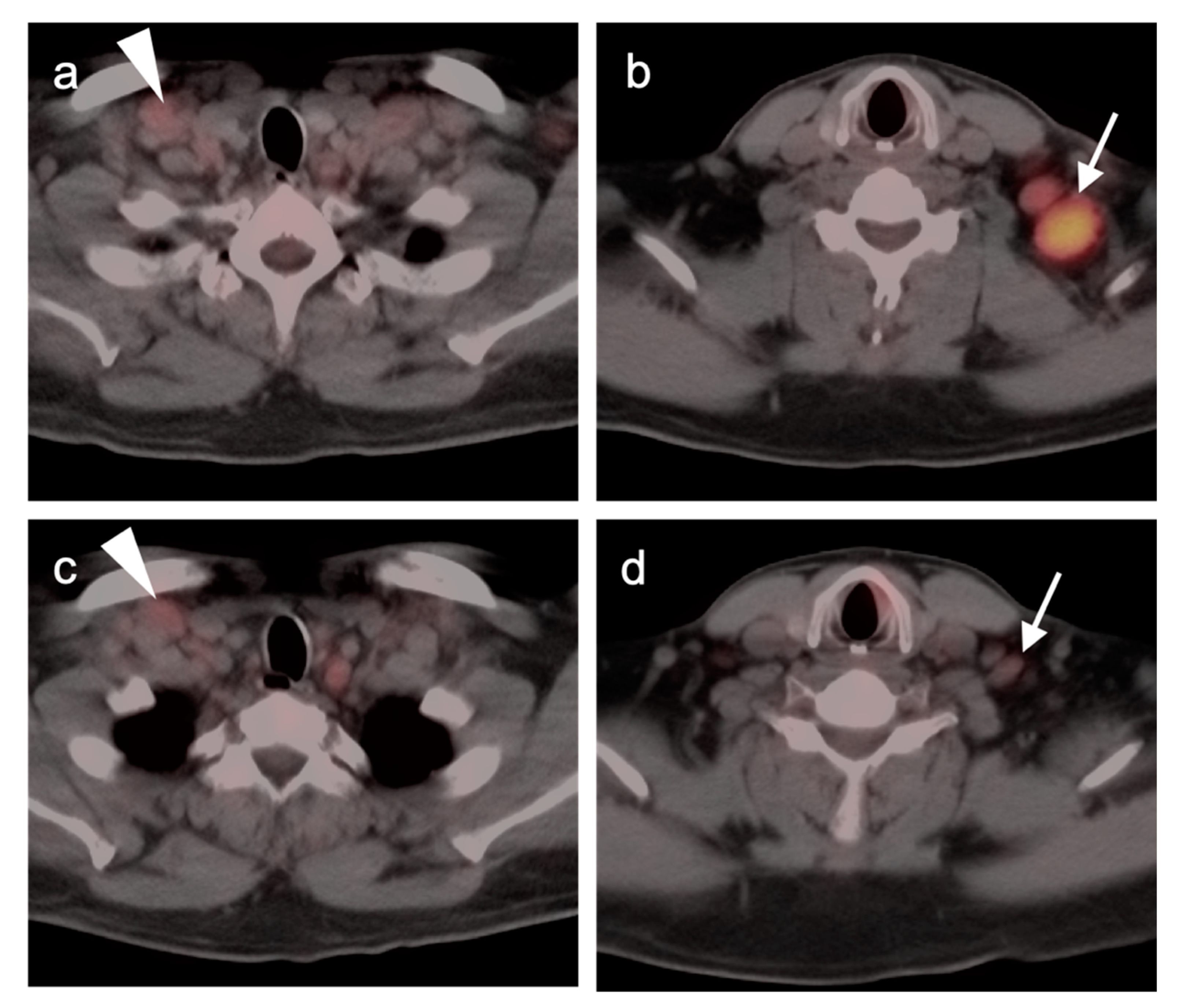 Cancers 14 05941 g012 Cancers 14 05941 g012