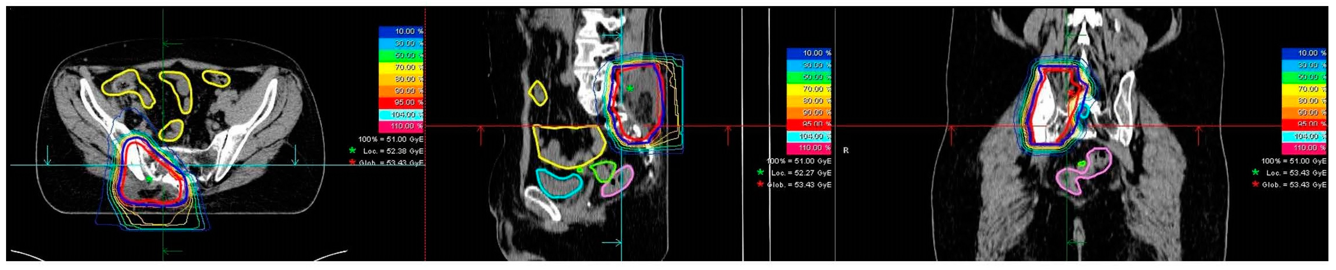Cancers 14 06045 g002 Cancers 14 06045 g002