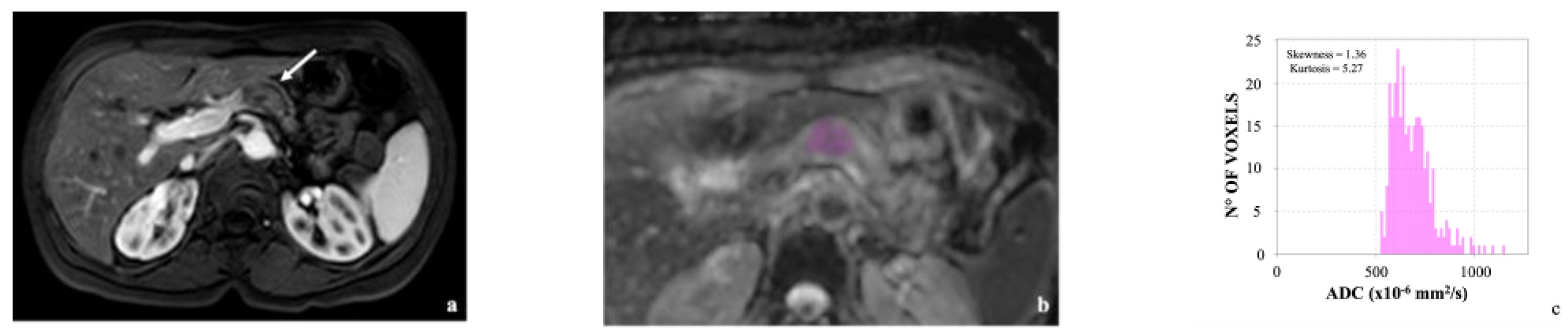 Cancers 14 06050 g002