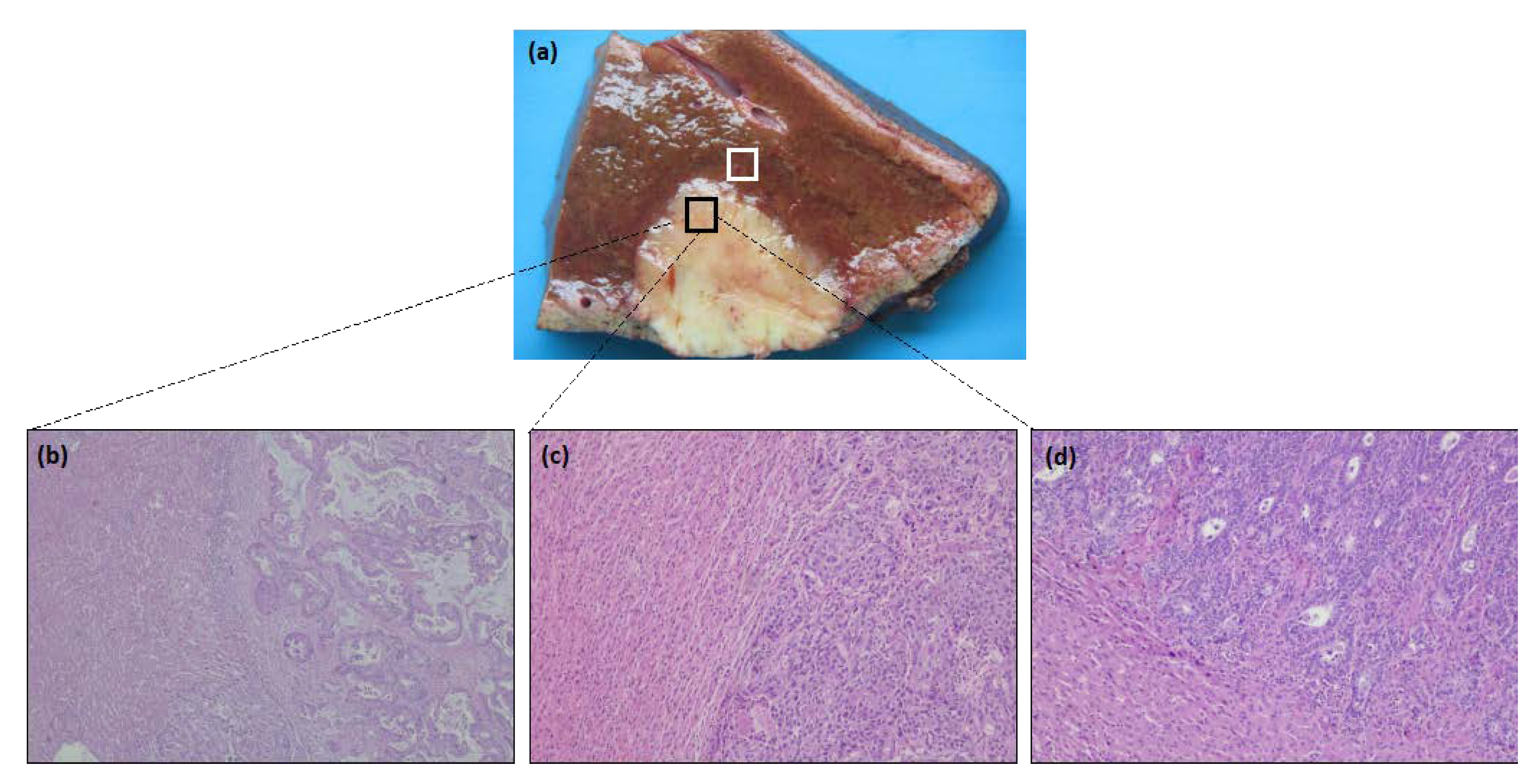 Cancers 14 06069 g001 Cancers 14 06069 g001
