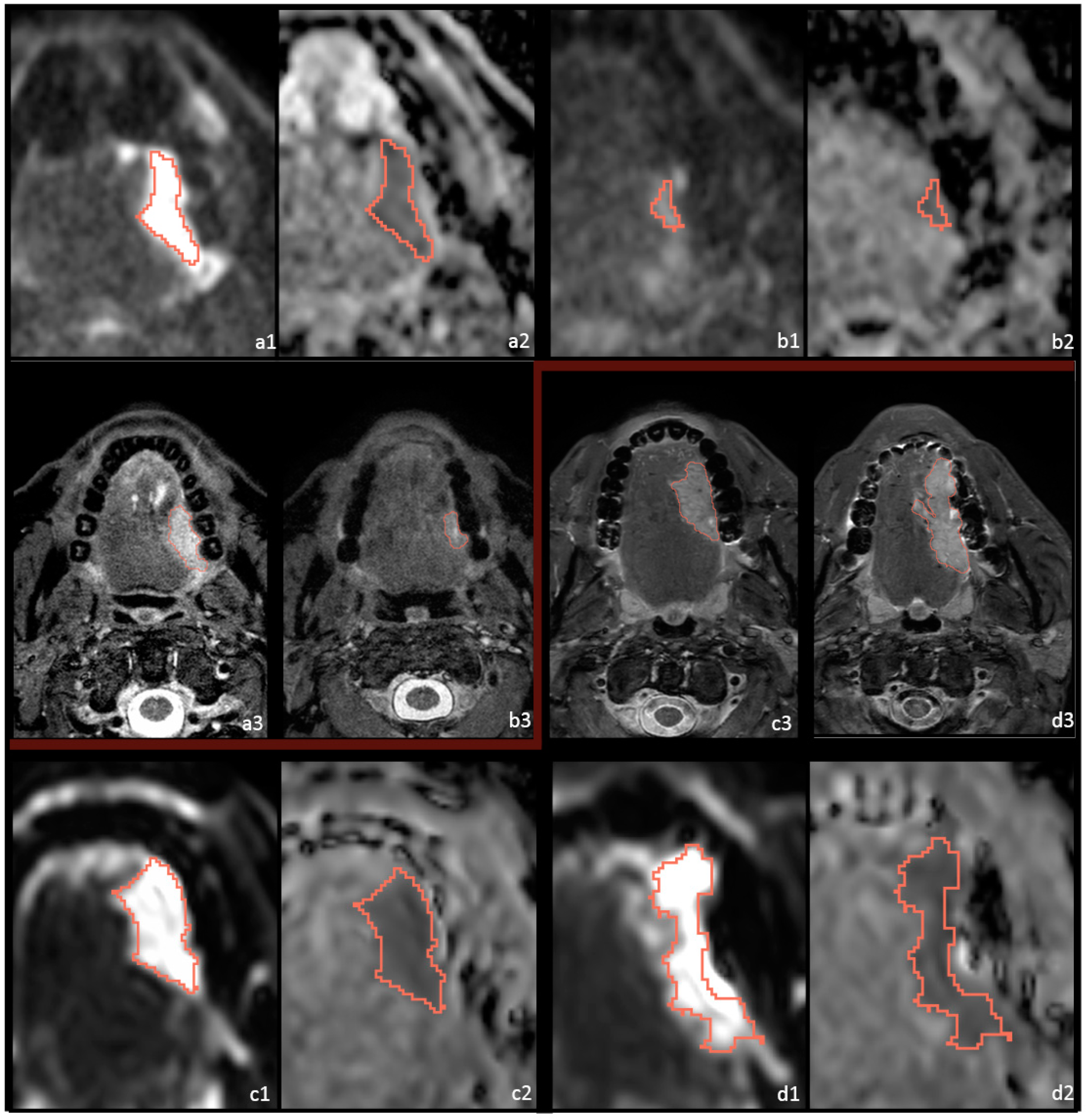 Cancers 14 06235 g001