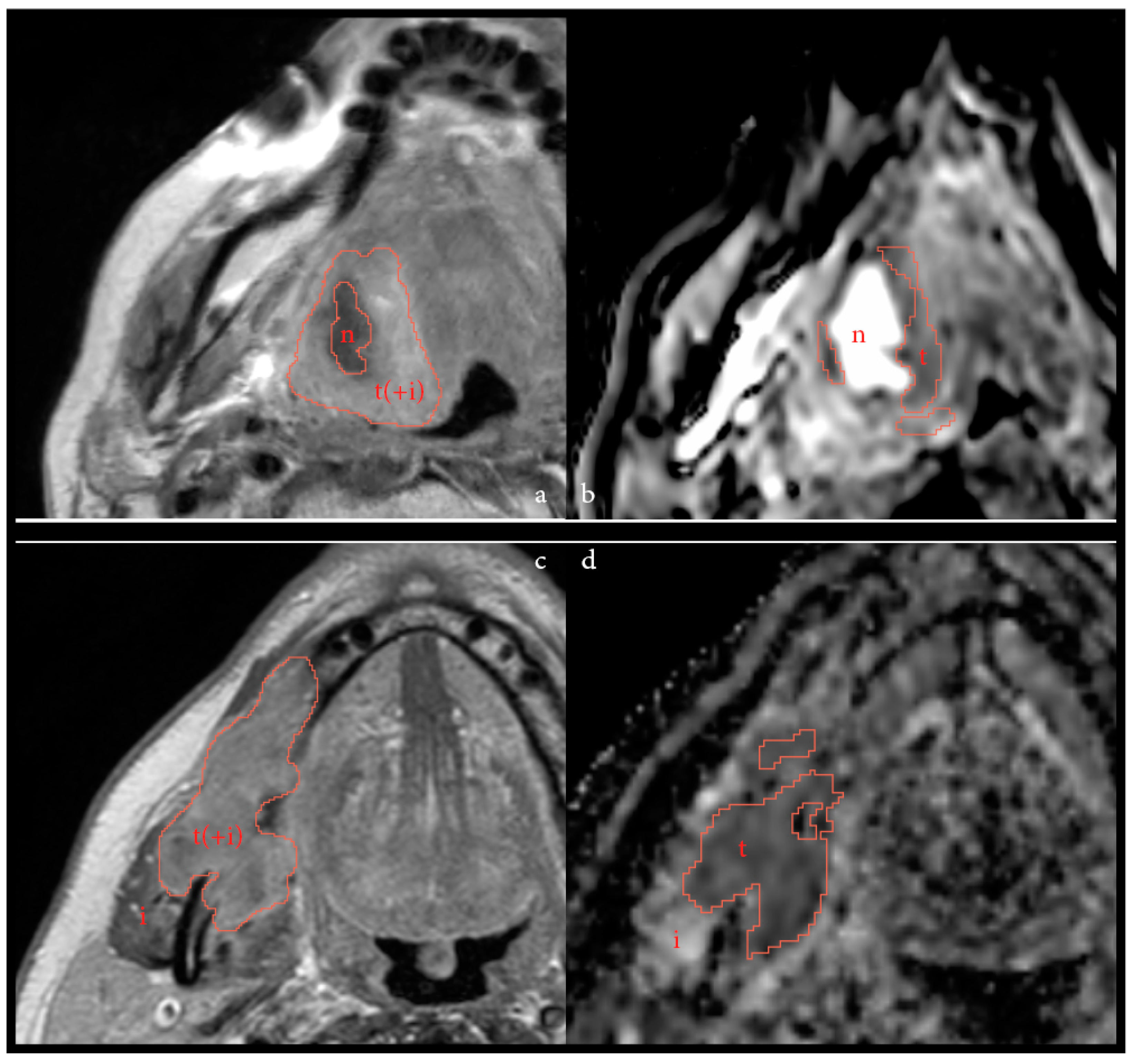 Cancers 14 06235 g004