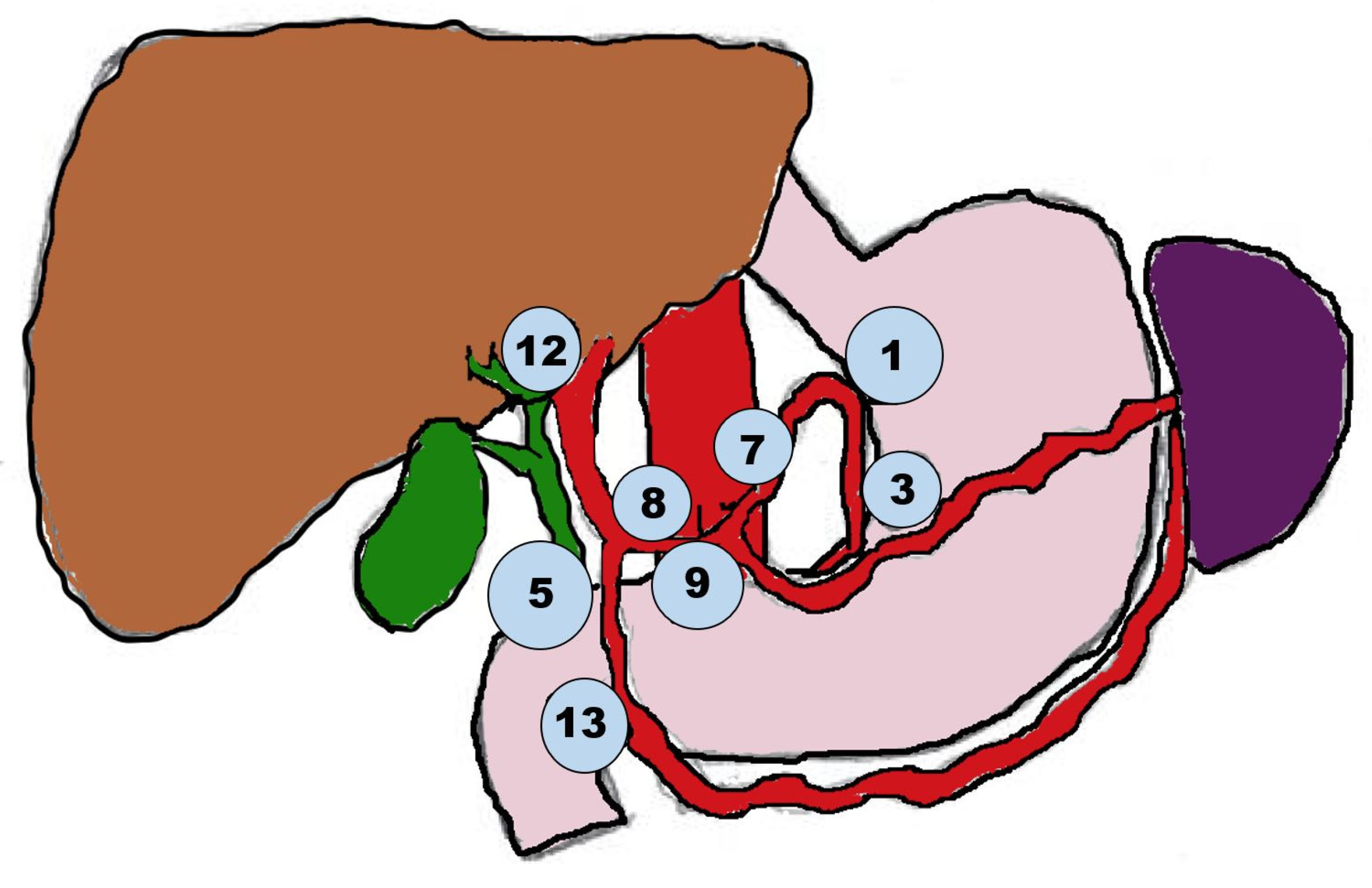 Cancers | Free Full-Text | Surgical Aspects of Intrahepatic