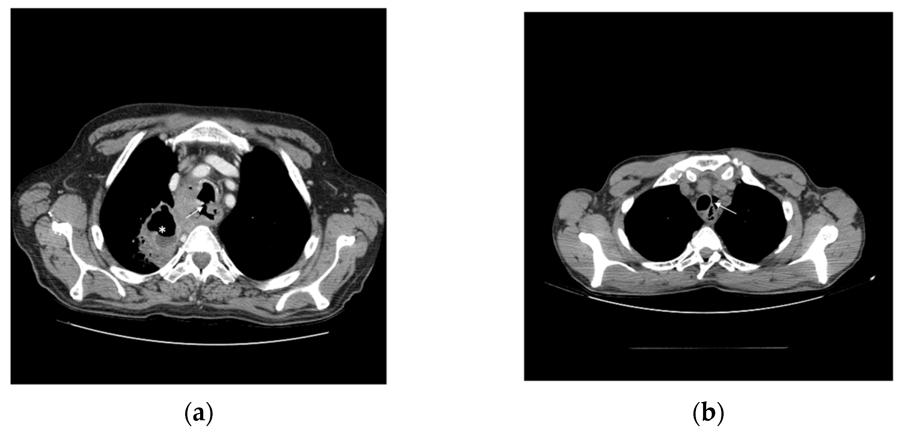 Cancers 14 06268 g002 Cancers 14 06268 g002