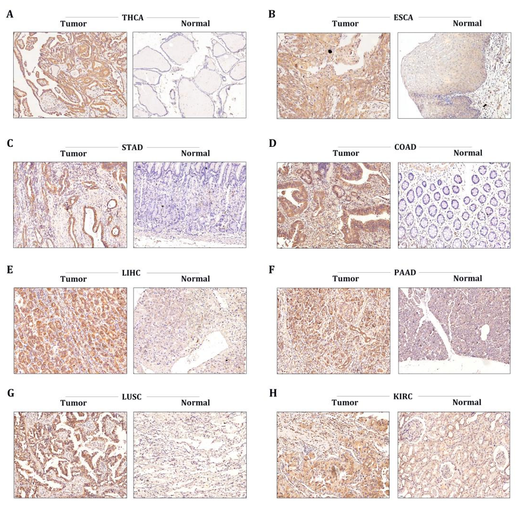 Cancers 15 00027 g006 Cancers 15 00027 g006