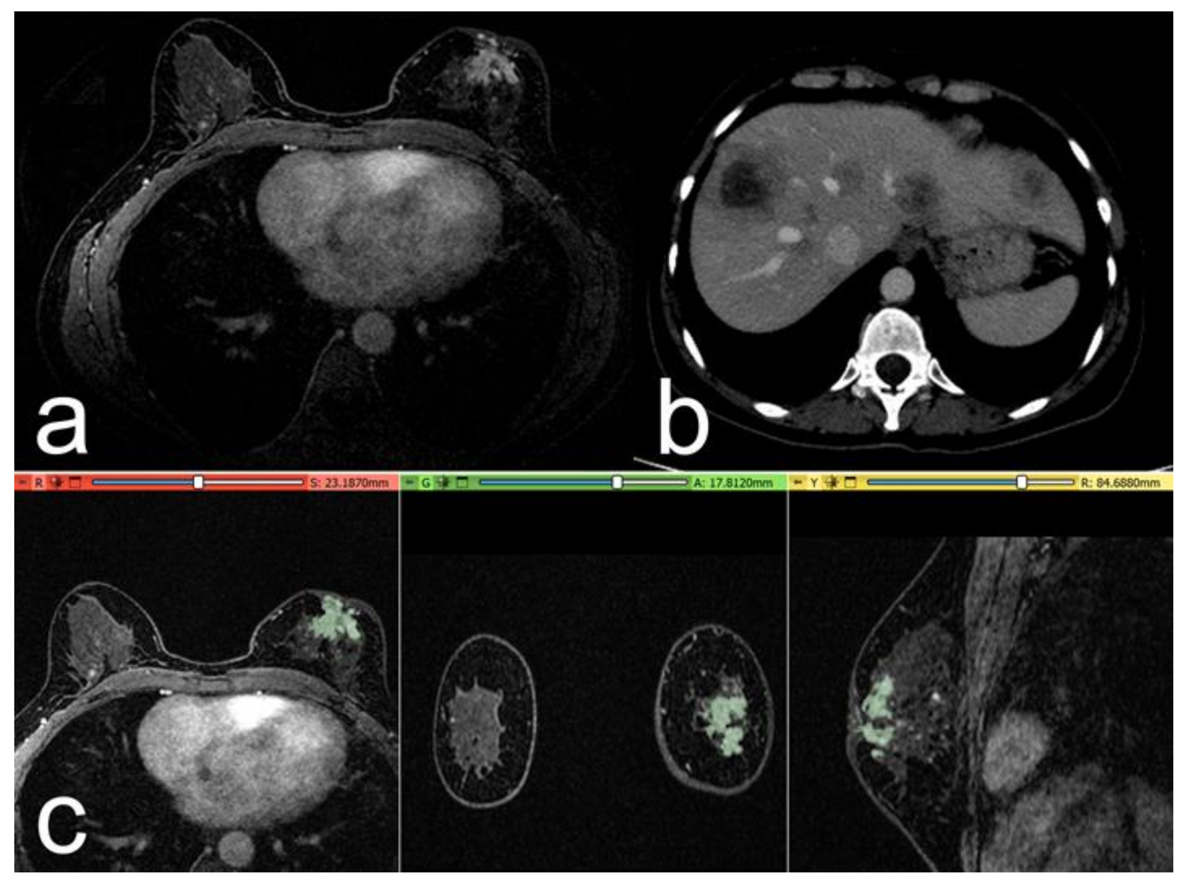 Cancers 15 00036 g003