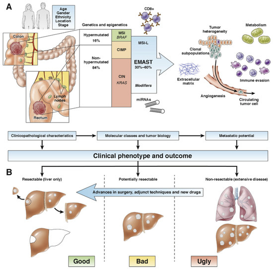 Cancers | Free Full-Text | Histopathological Growth Pattern in Colorectal  Liver Metastasis and The Tumor Immune Microenvironment