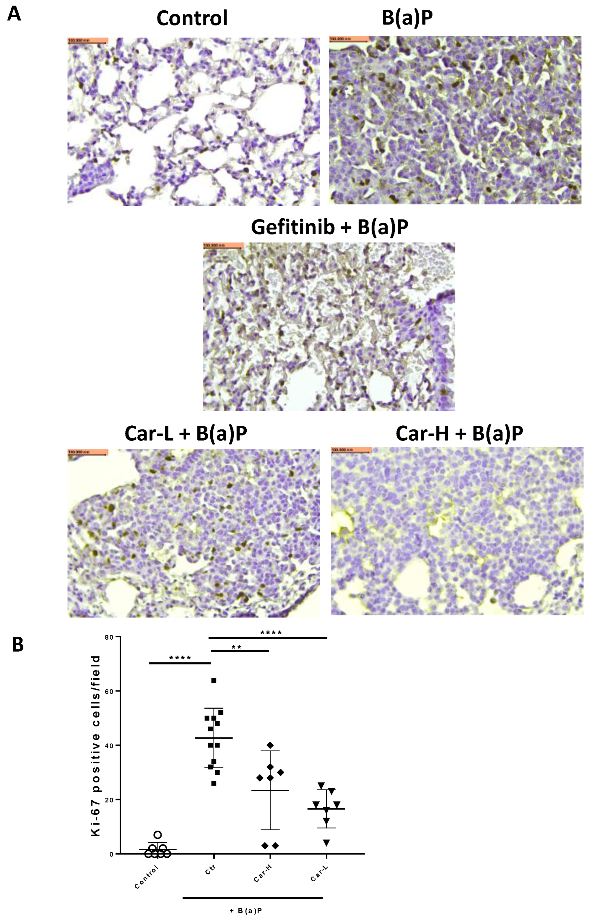 Cancers 15 00583 g006 Cancers 15 00583 g006