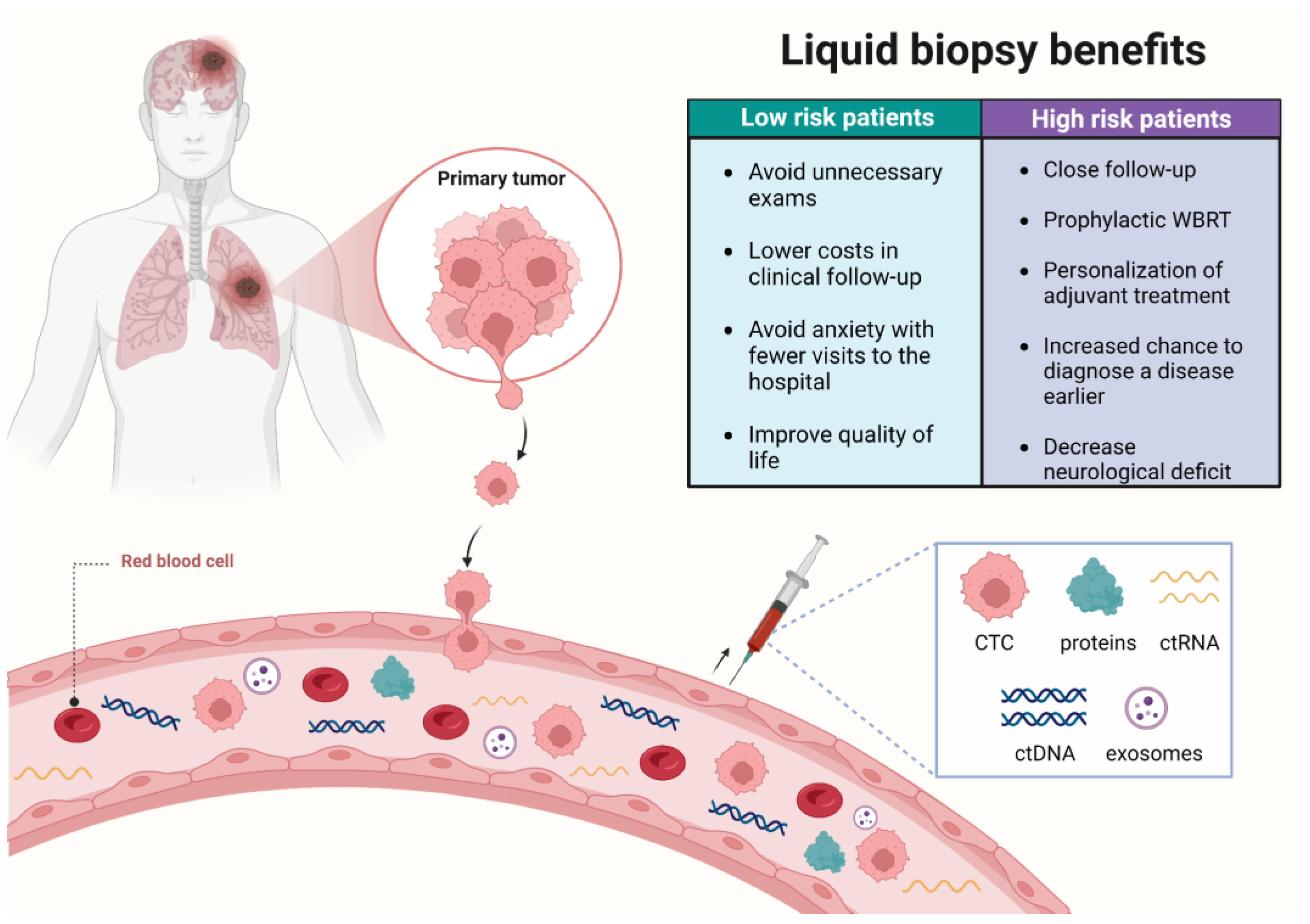 Advances In The Molecular Landscape Of Lung Cancer Brain Metastasis