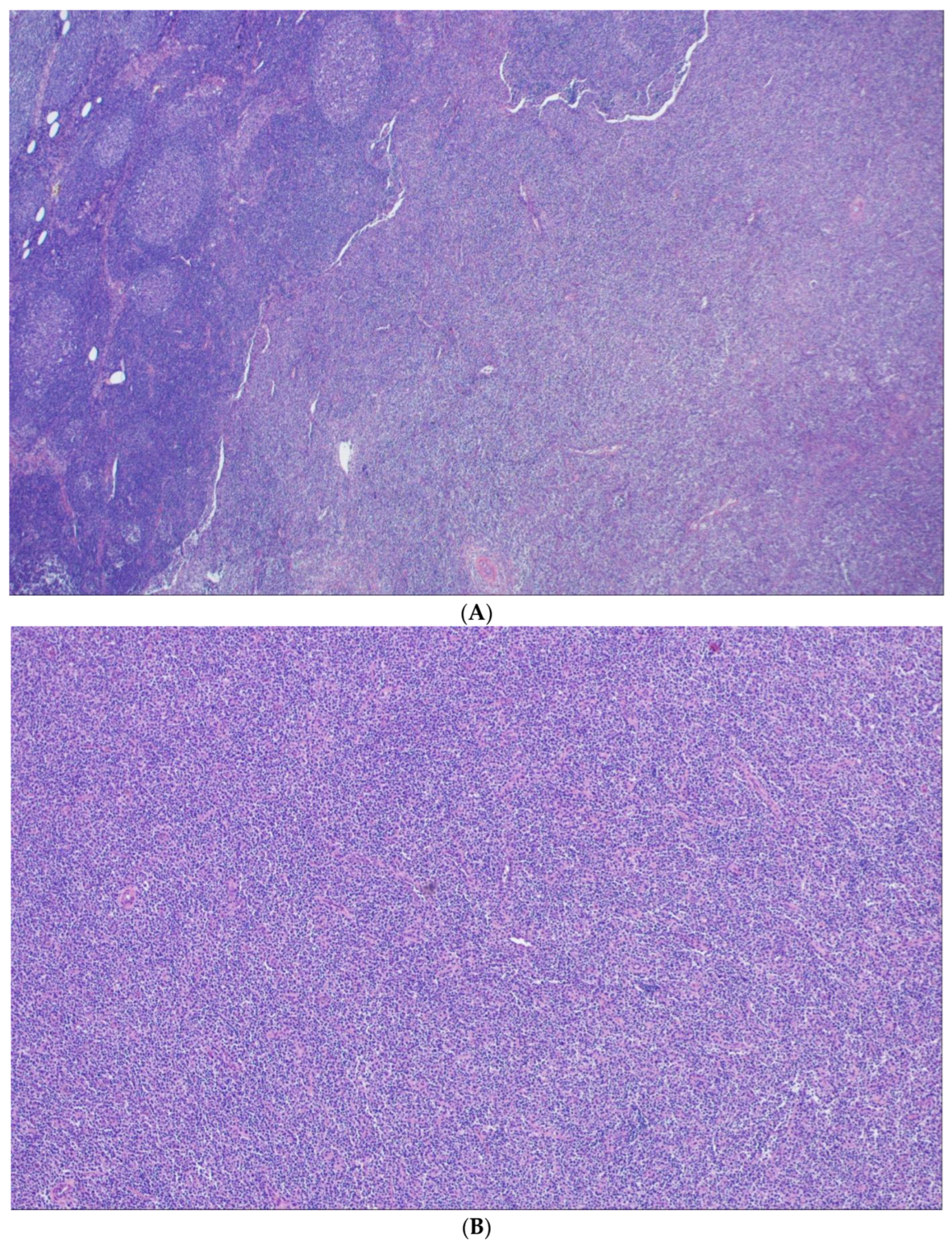 Cancers 15 00785 g005 Cancers 15 00785 g005