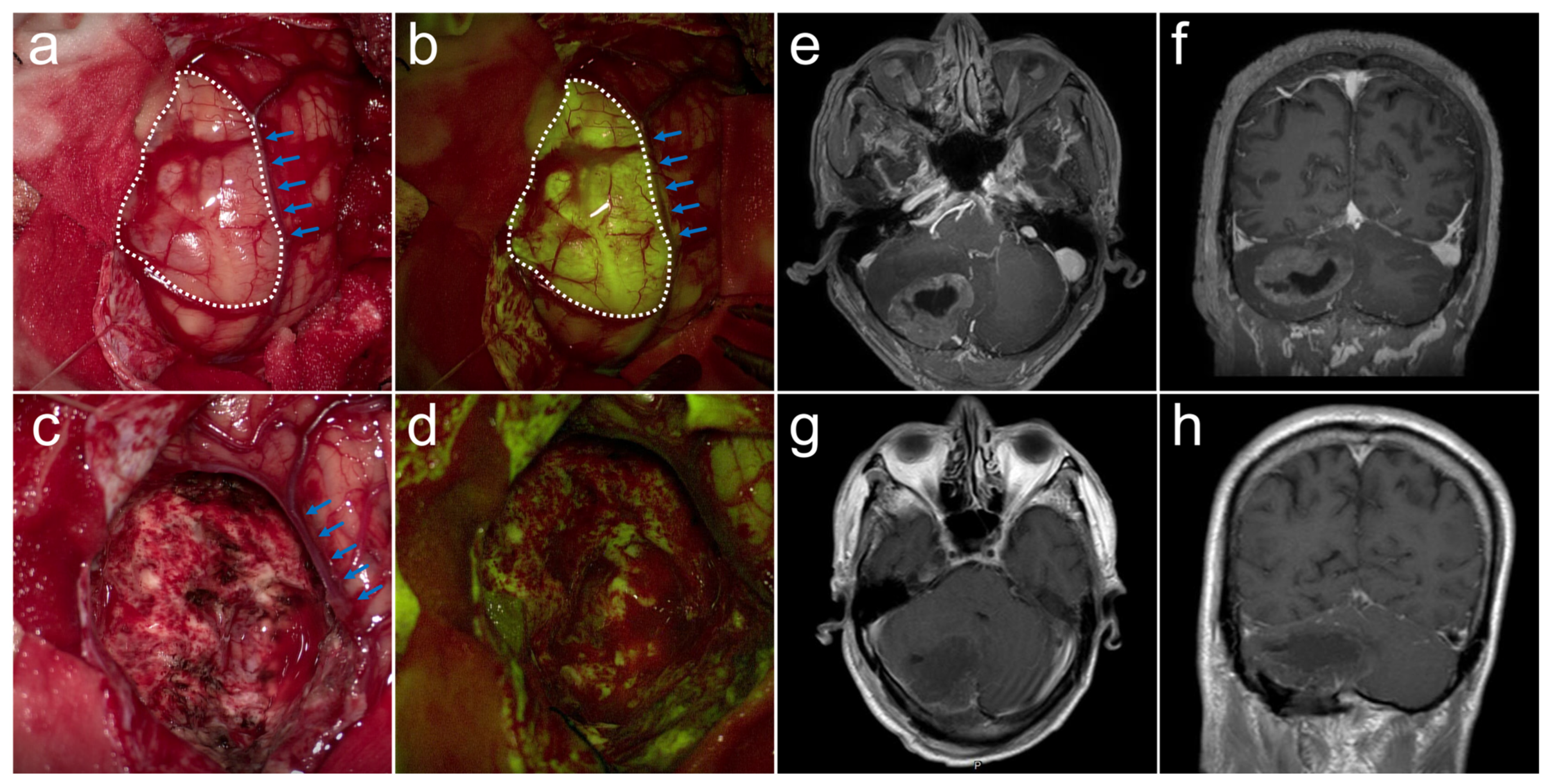 Cancers 15 00882 g001 Cancers 15 00882 g001