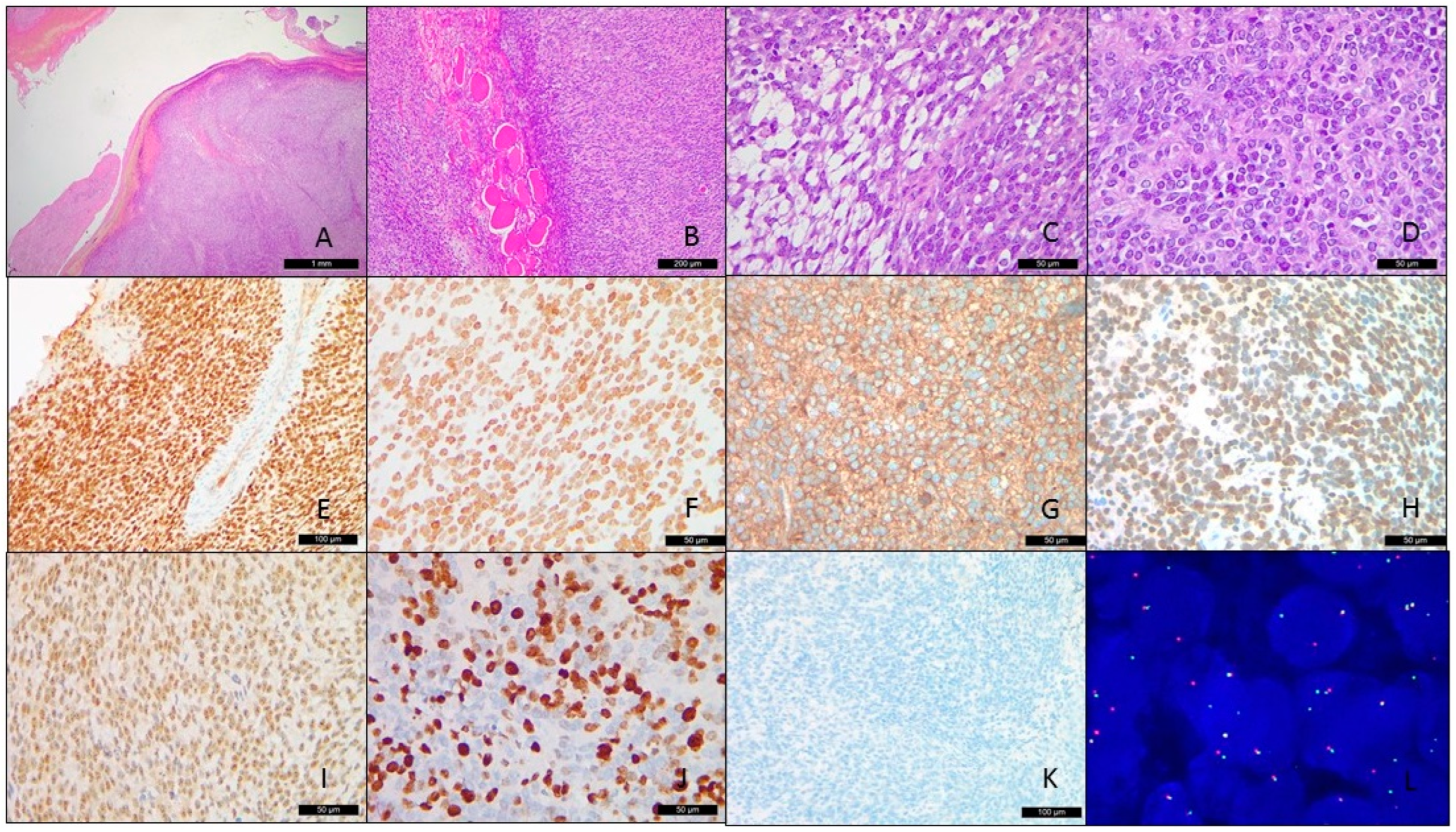 Cancers 15 00898 g002