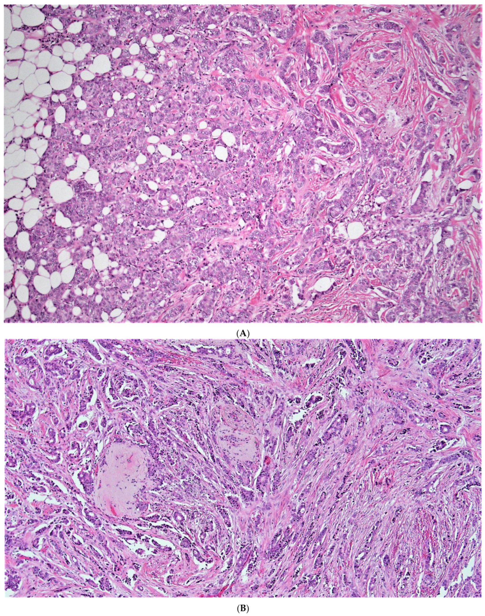 Cancers 15 00903 g004