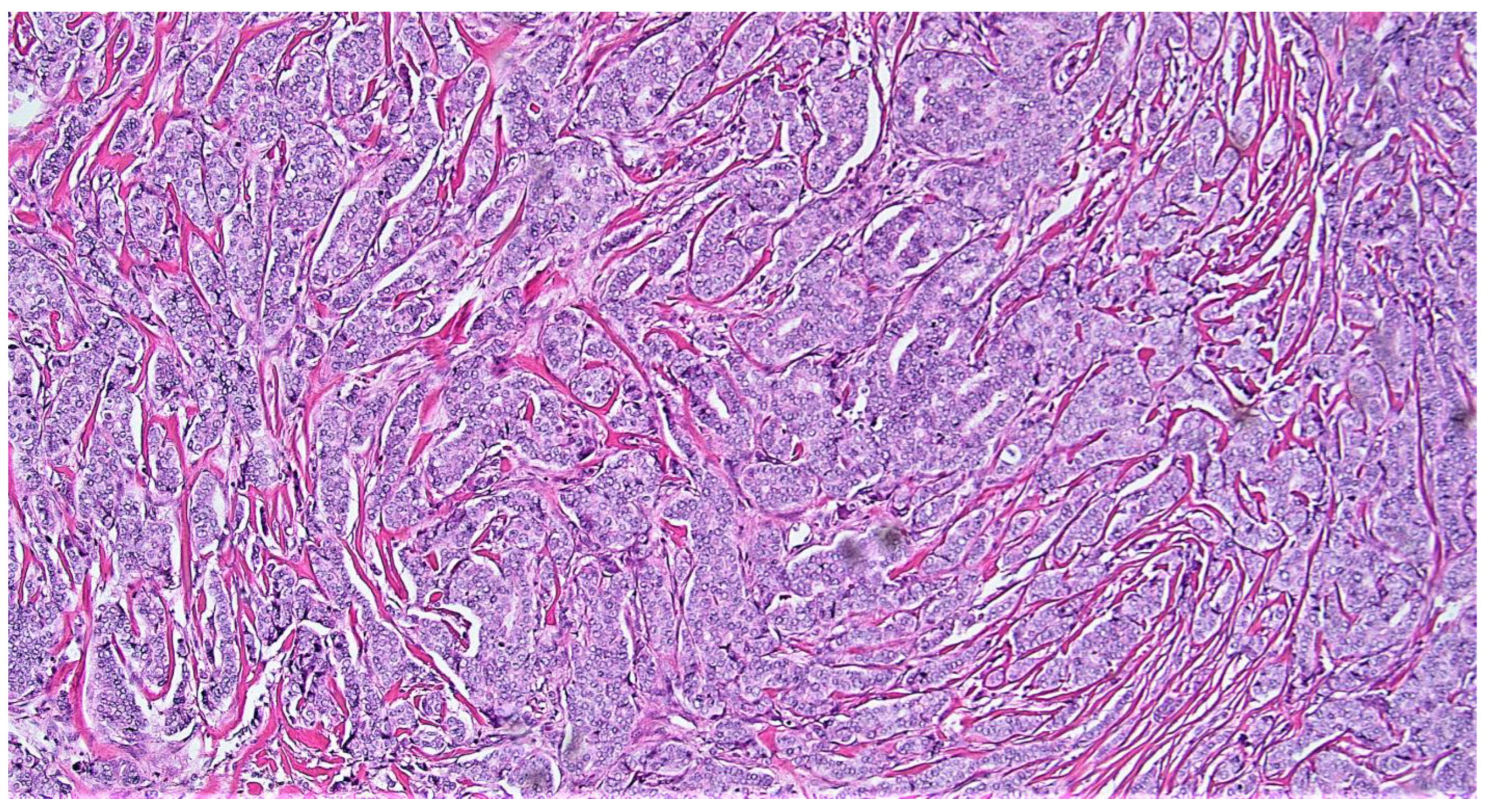 Cancers 15 00903 g005