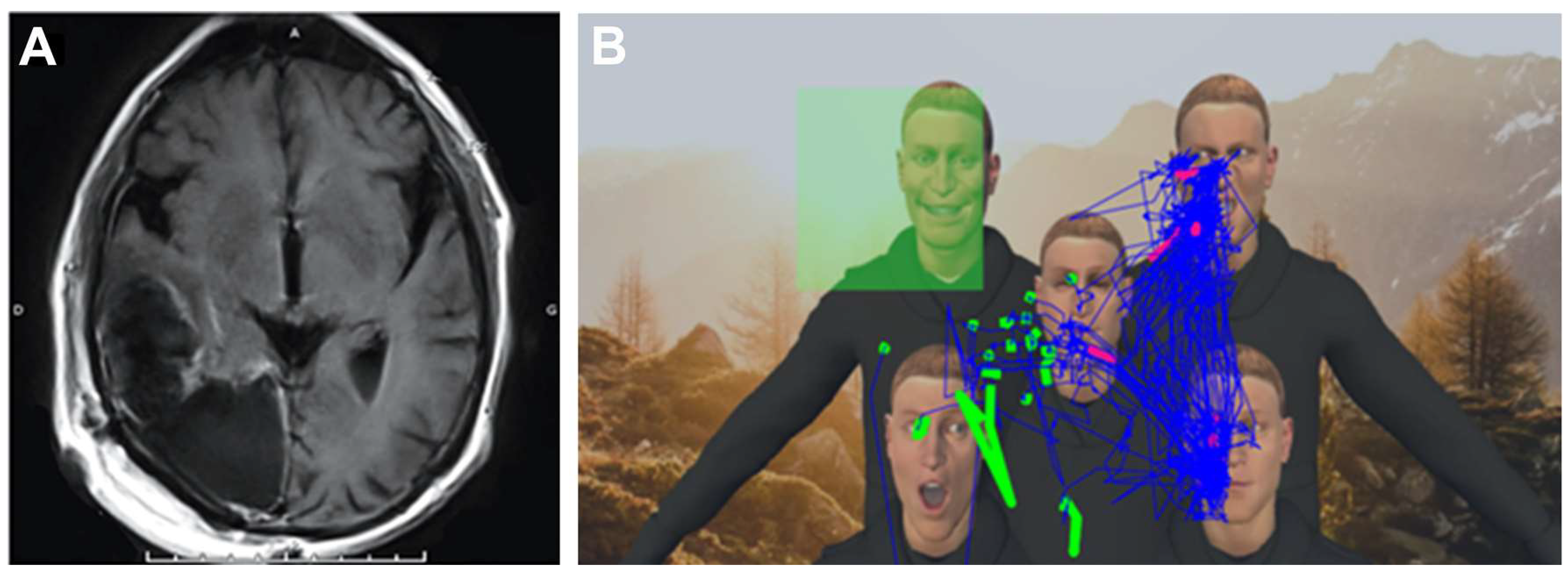 Cancers 15 00949 g003