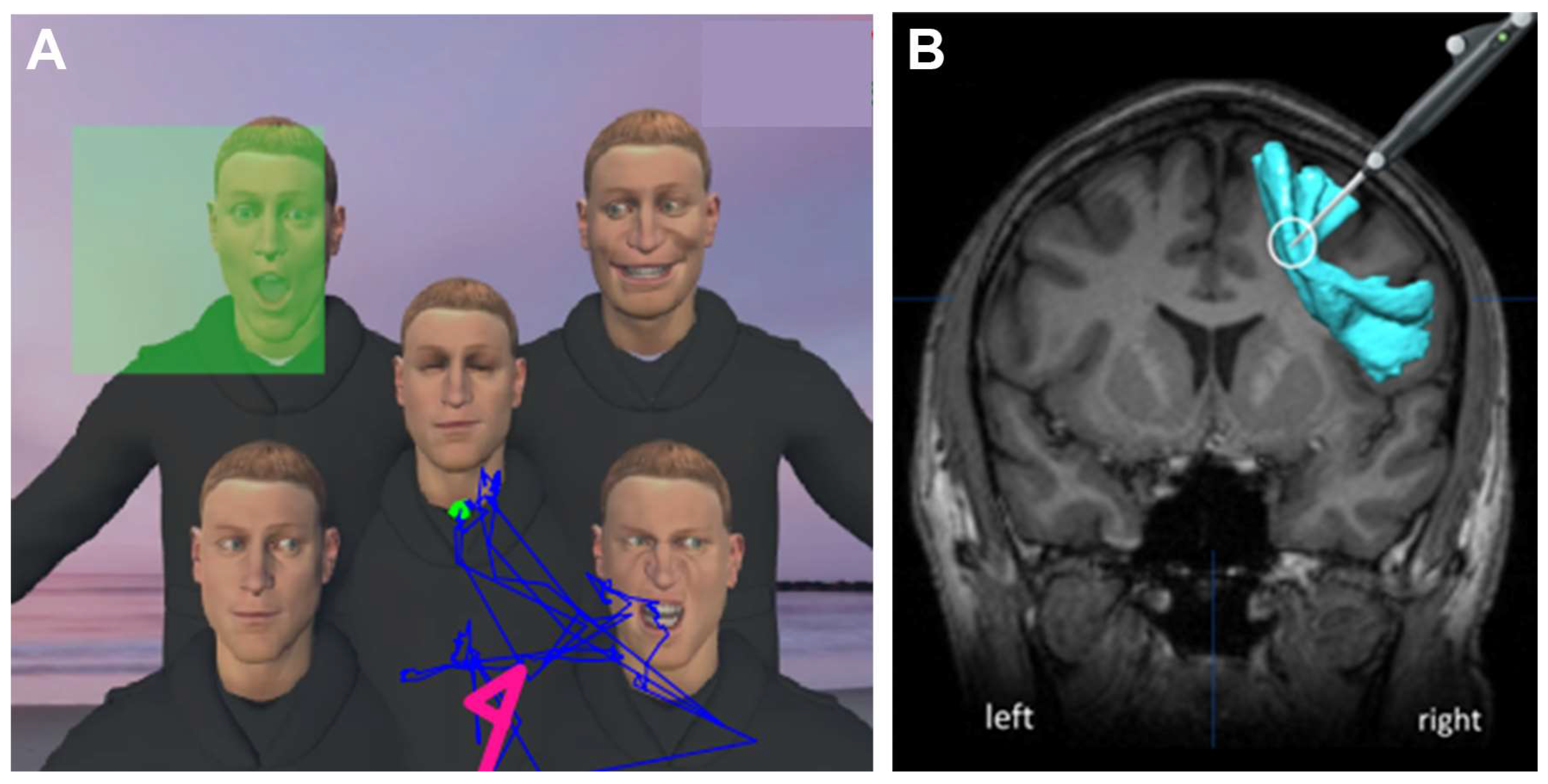 Cancers 15 00949 g005