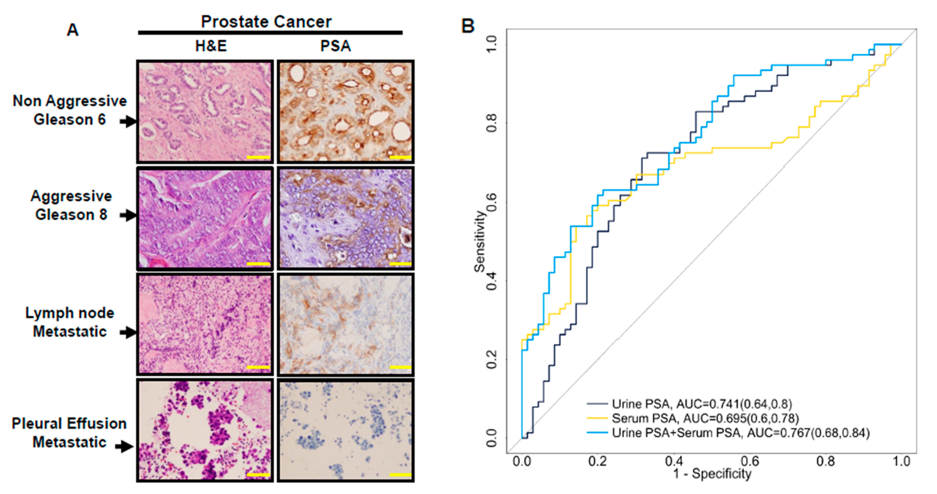 Cancers 15 00960 g002 Cancers 15 00960 g002