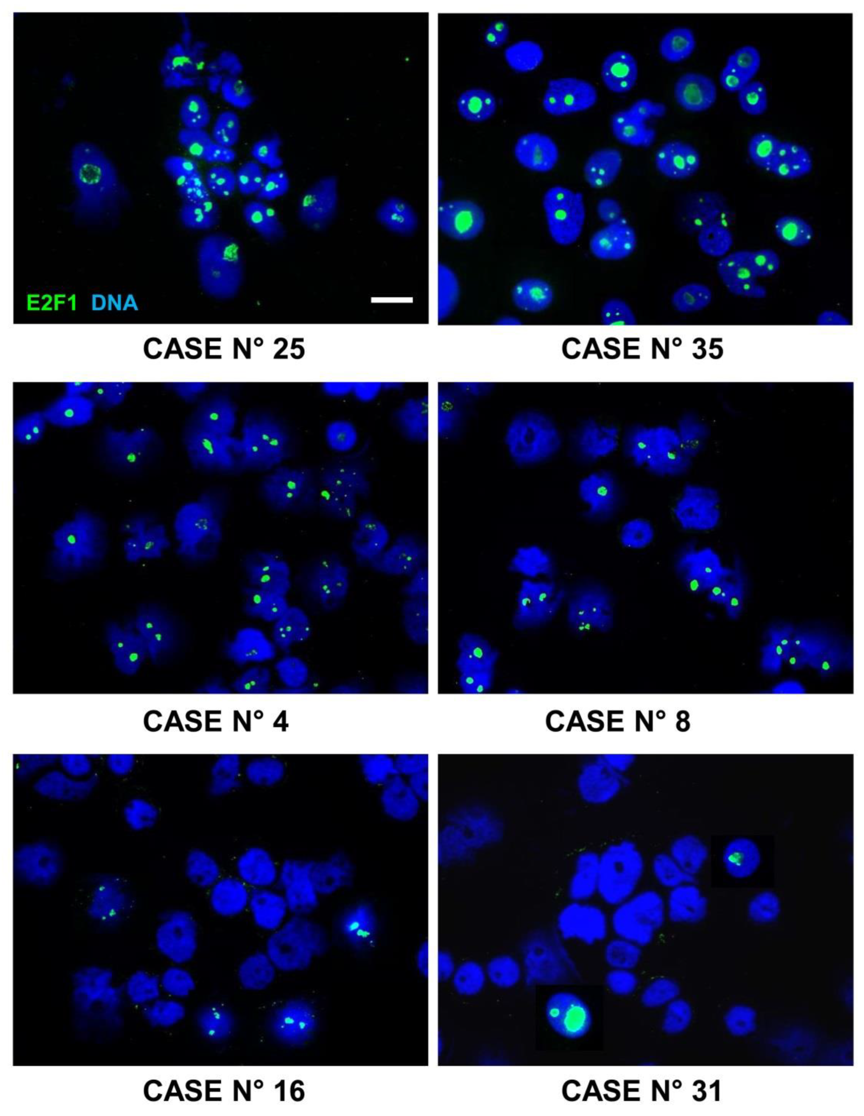 Cancers 15 01188 g009 Cancers 15 01188 g009
