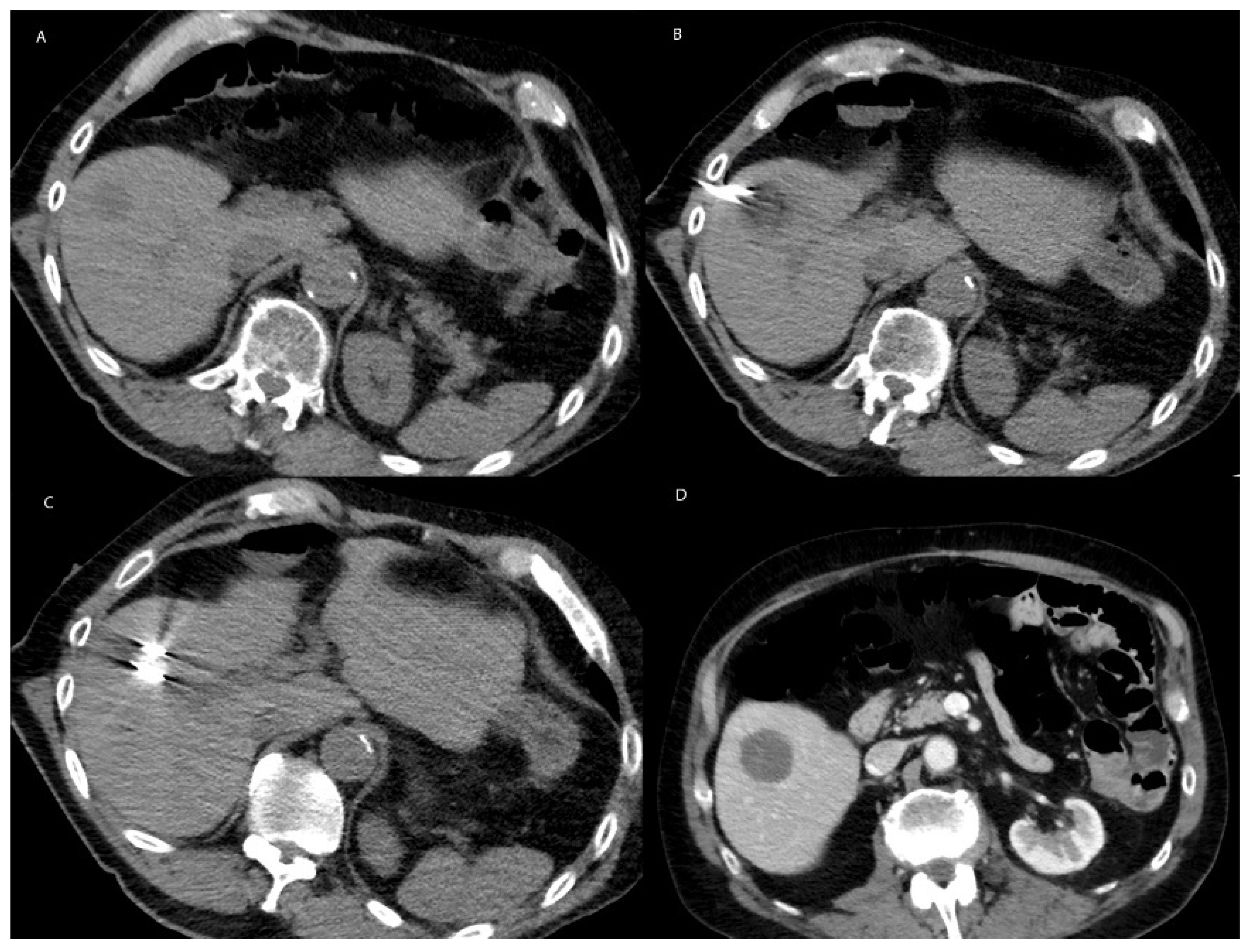 Cancers 15 01200 g002 Cancers 15 01200 g002