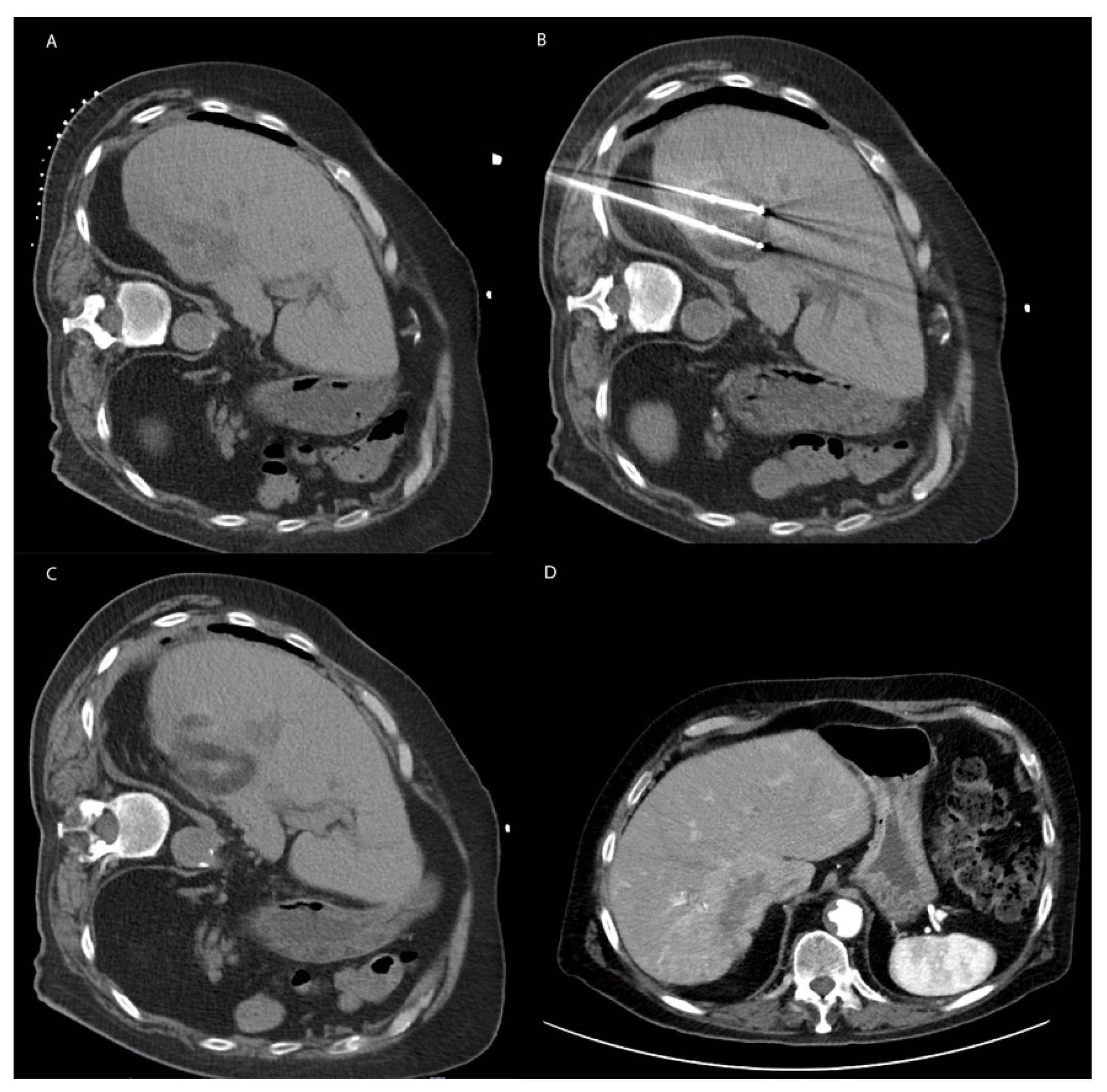 Cancers 15 01200 g003 Cancers 15 01200 g003