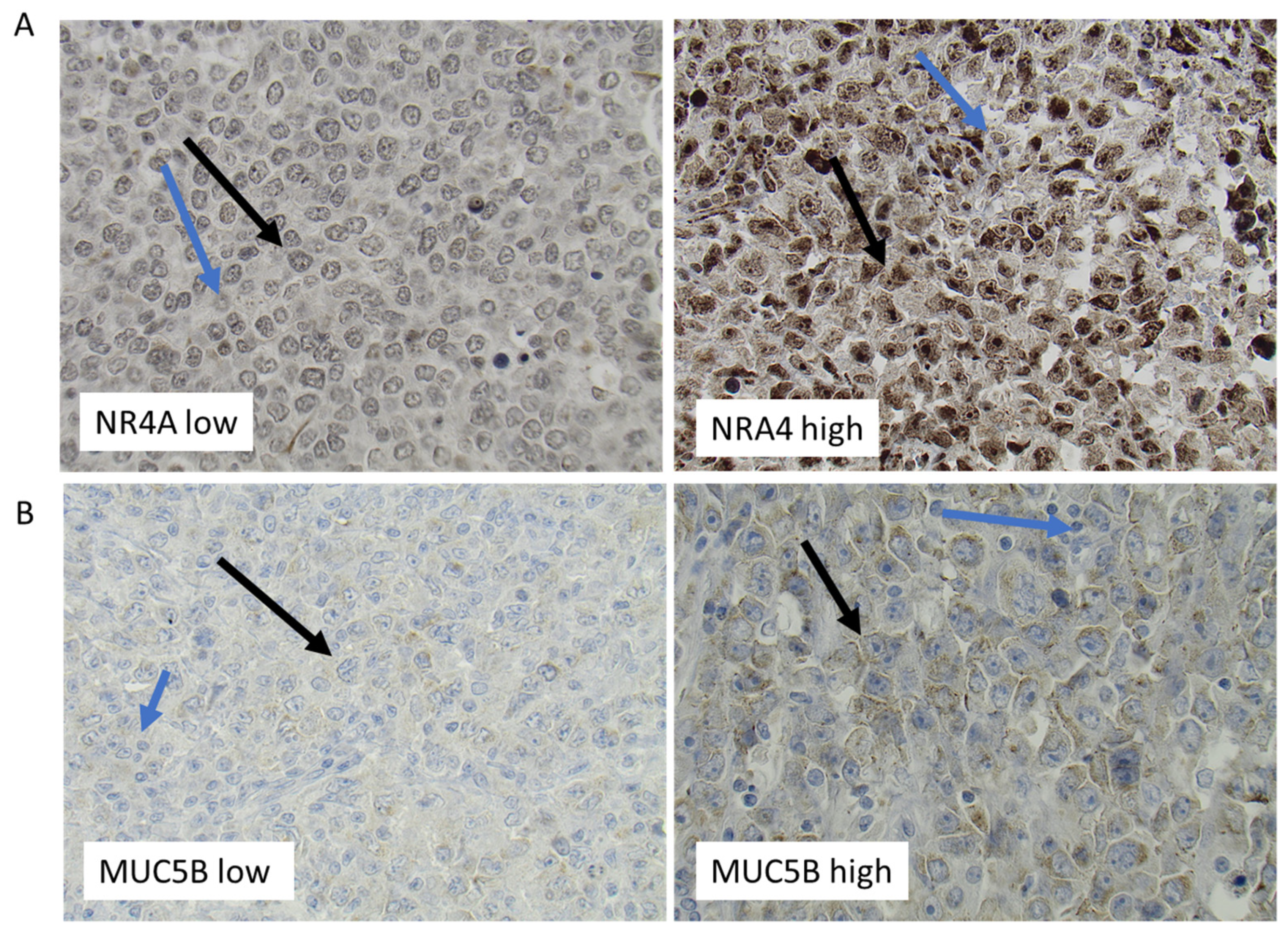 Cancers 15 01298 g005 Cancers 15 01298 g005